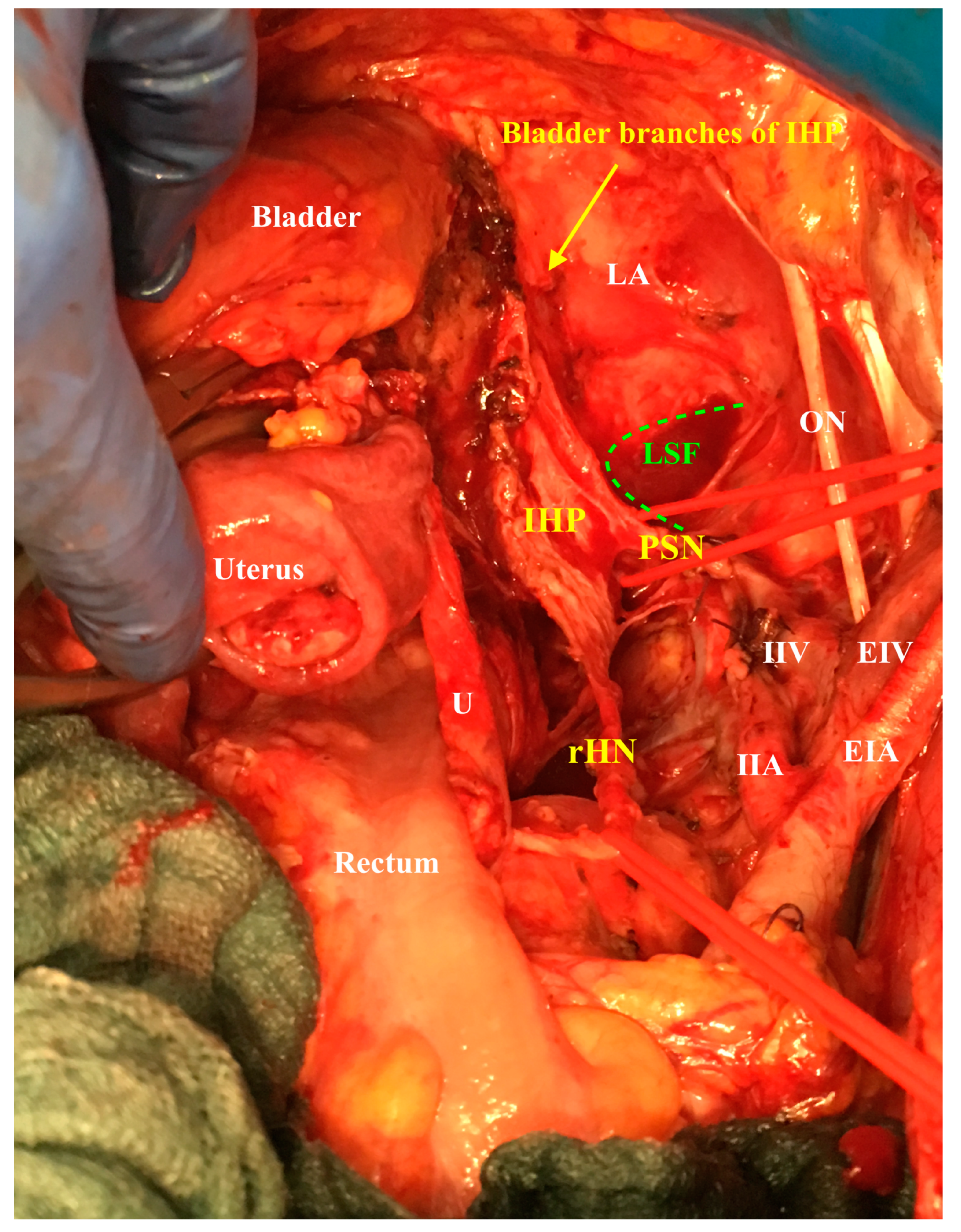 Cancers 12 01839 g005