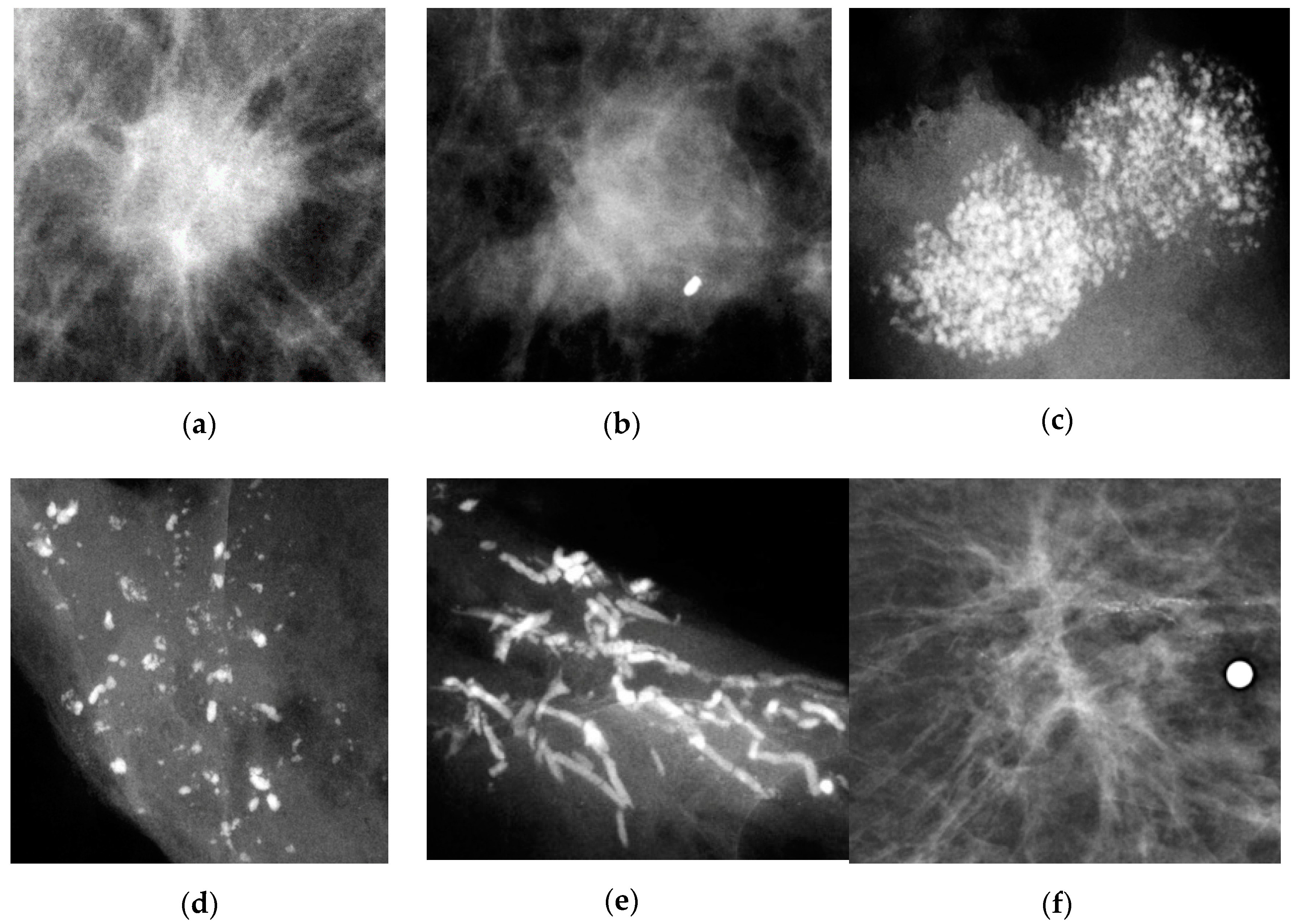 Cancers 12 01855 g006 Cancers 12 01855 g006