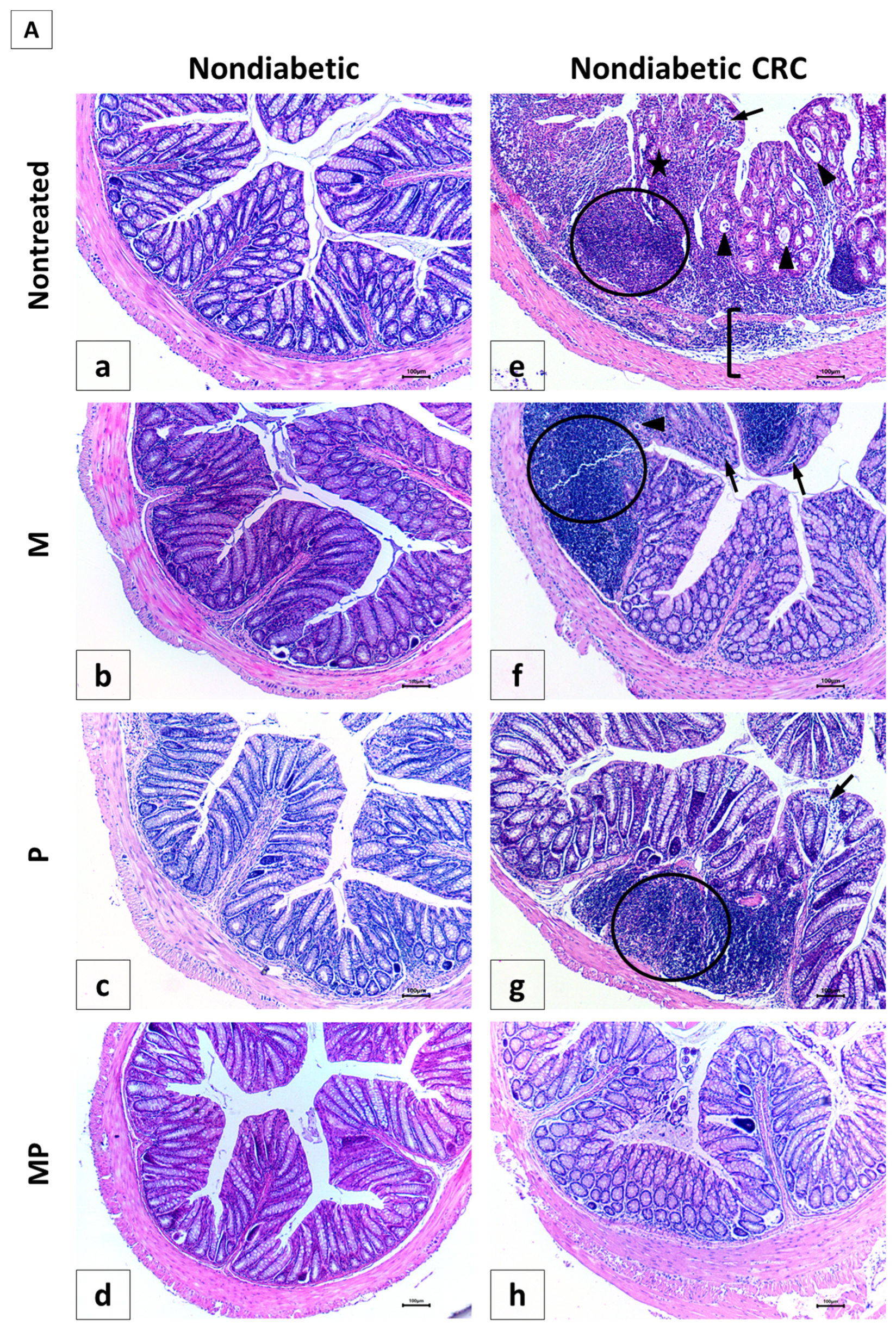 Cancers 12 01857 g007a