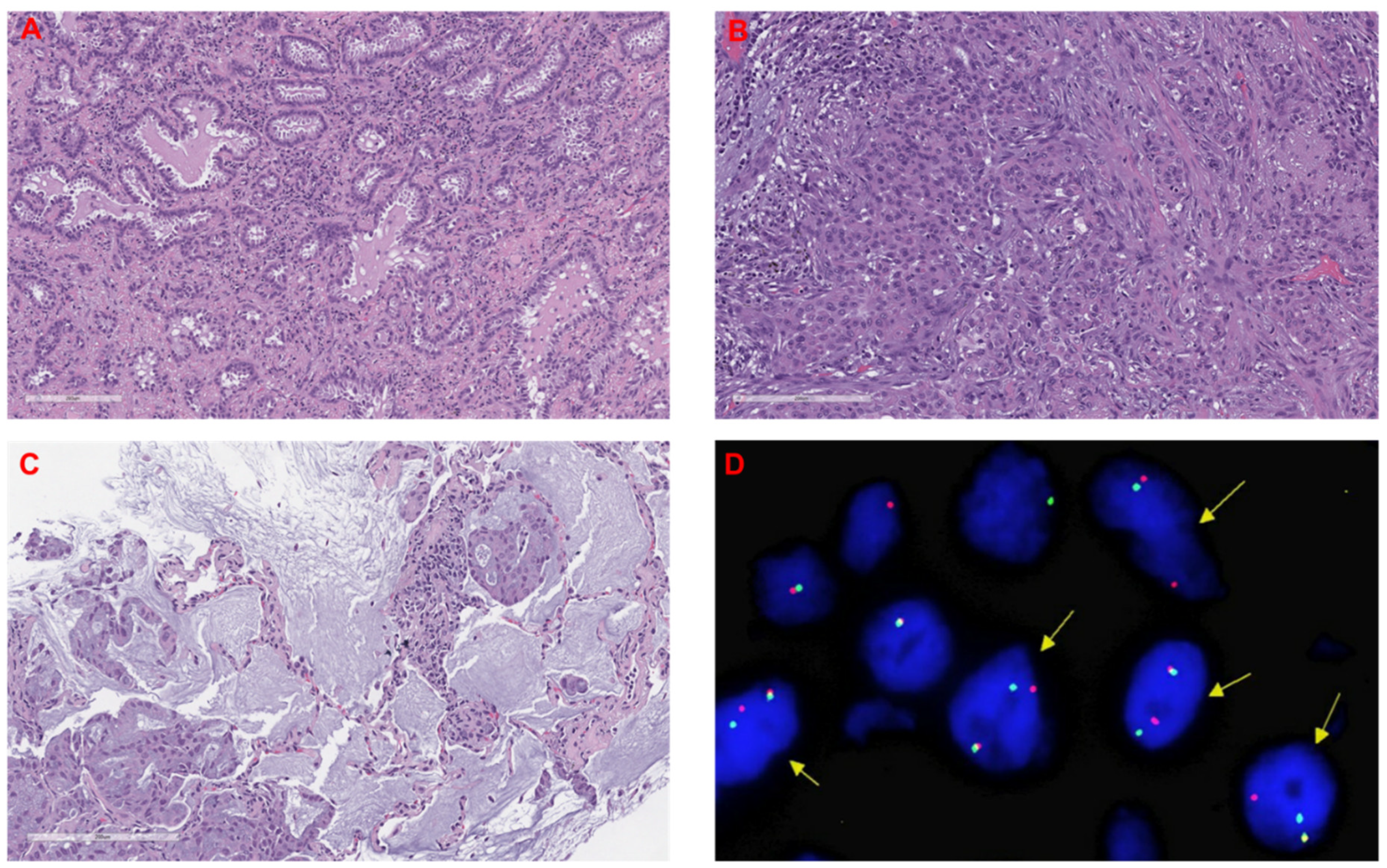 Cancers 12 01903 g002 Cancers 12 01903 g002