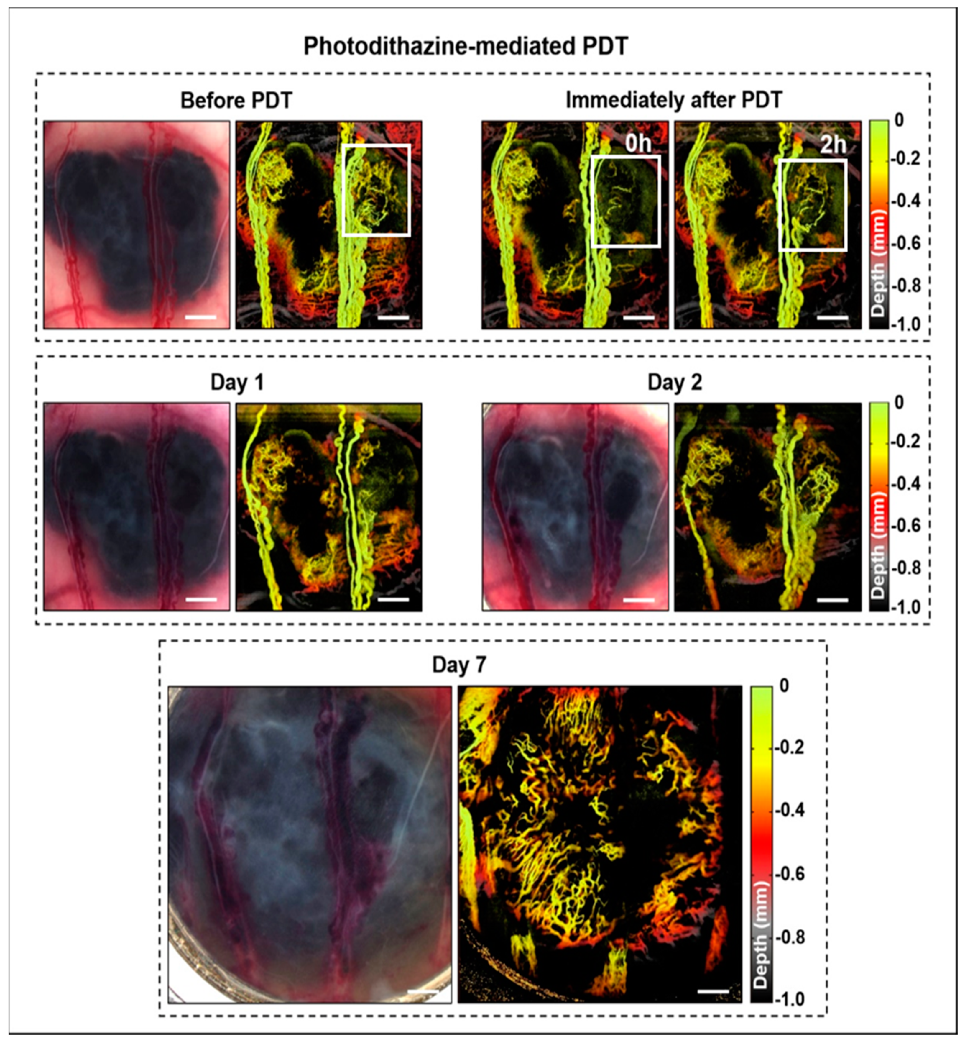 Cancers 12 01956 g001