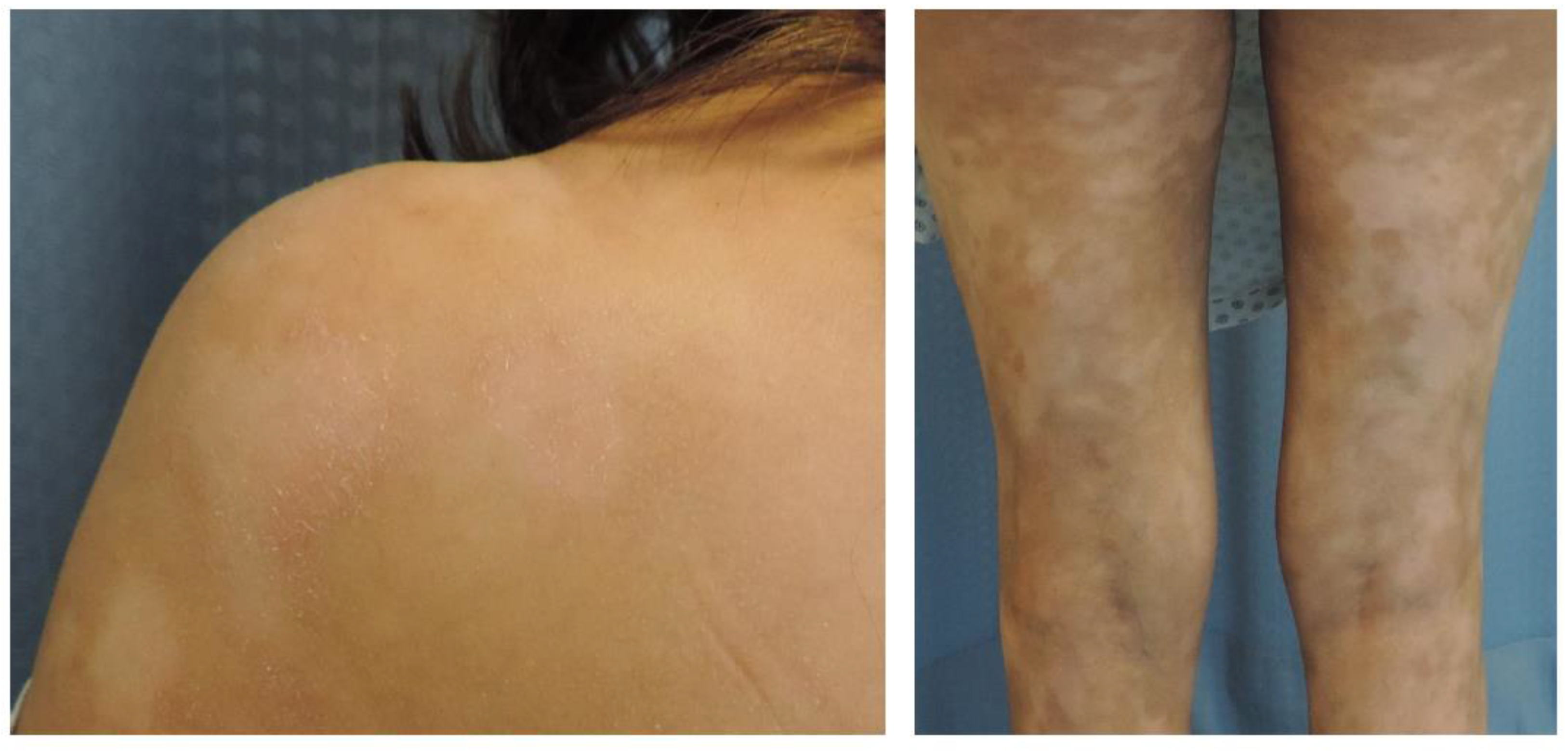 Cancers 12 02007 g001