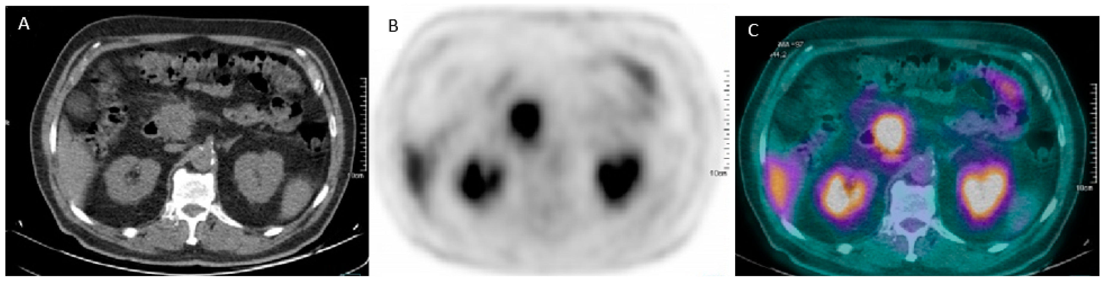 Cancers 12 02016 g001