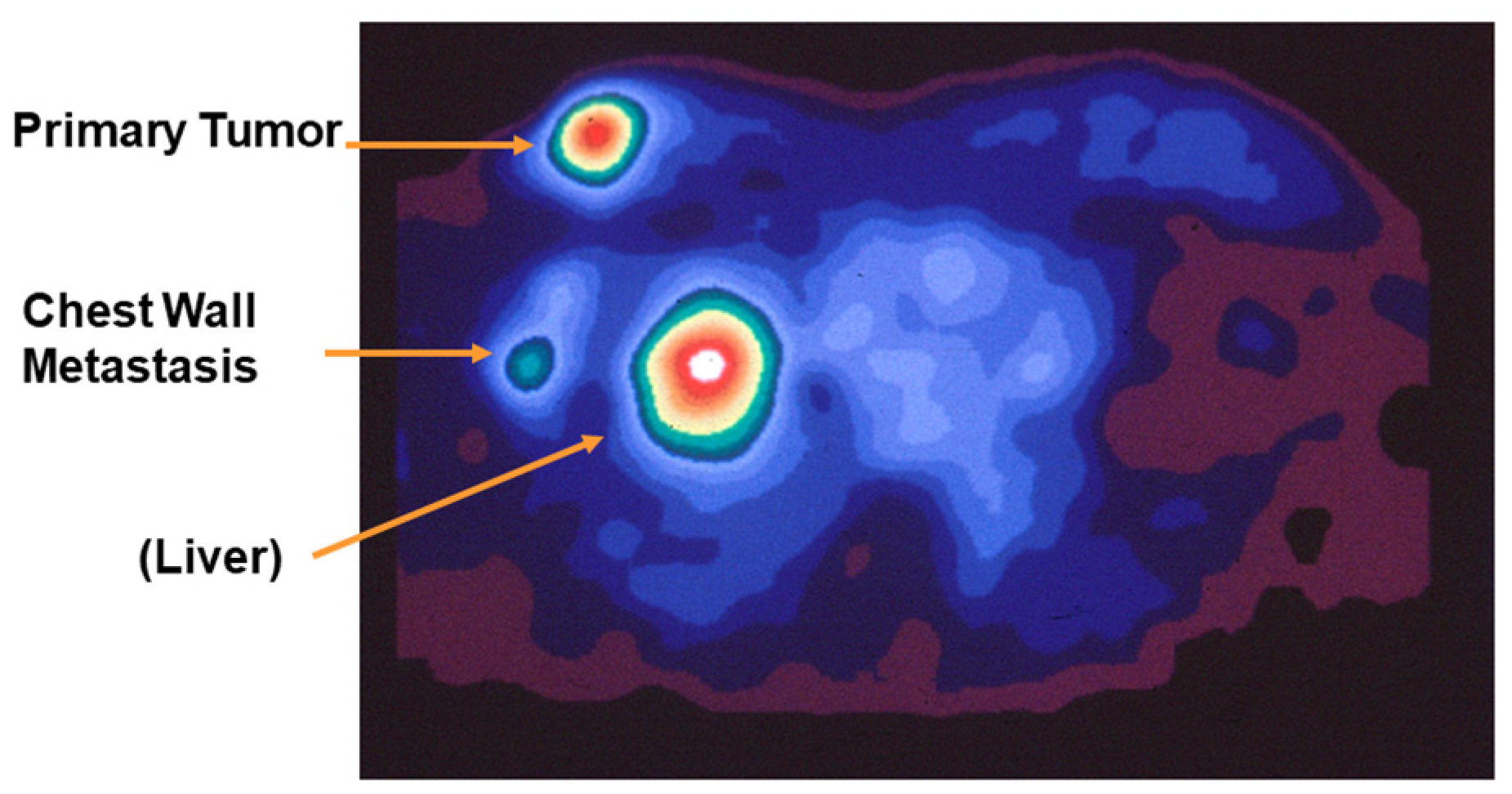 Cancers 12 02020 g006