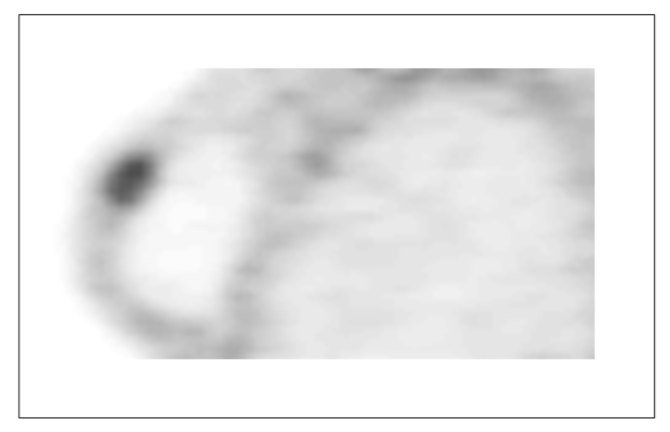 Cancers 12 02020 g020