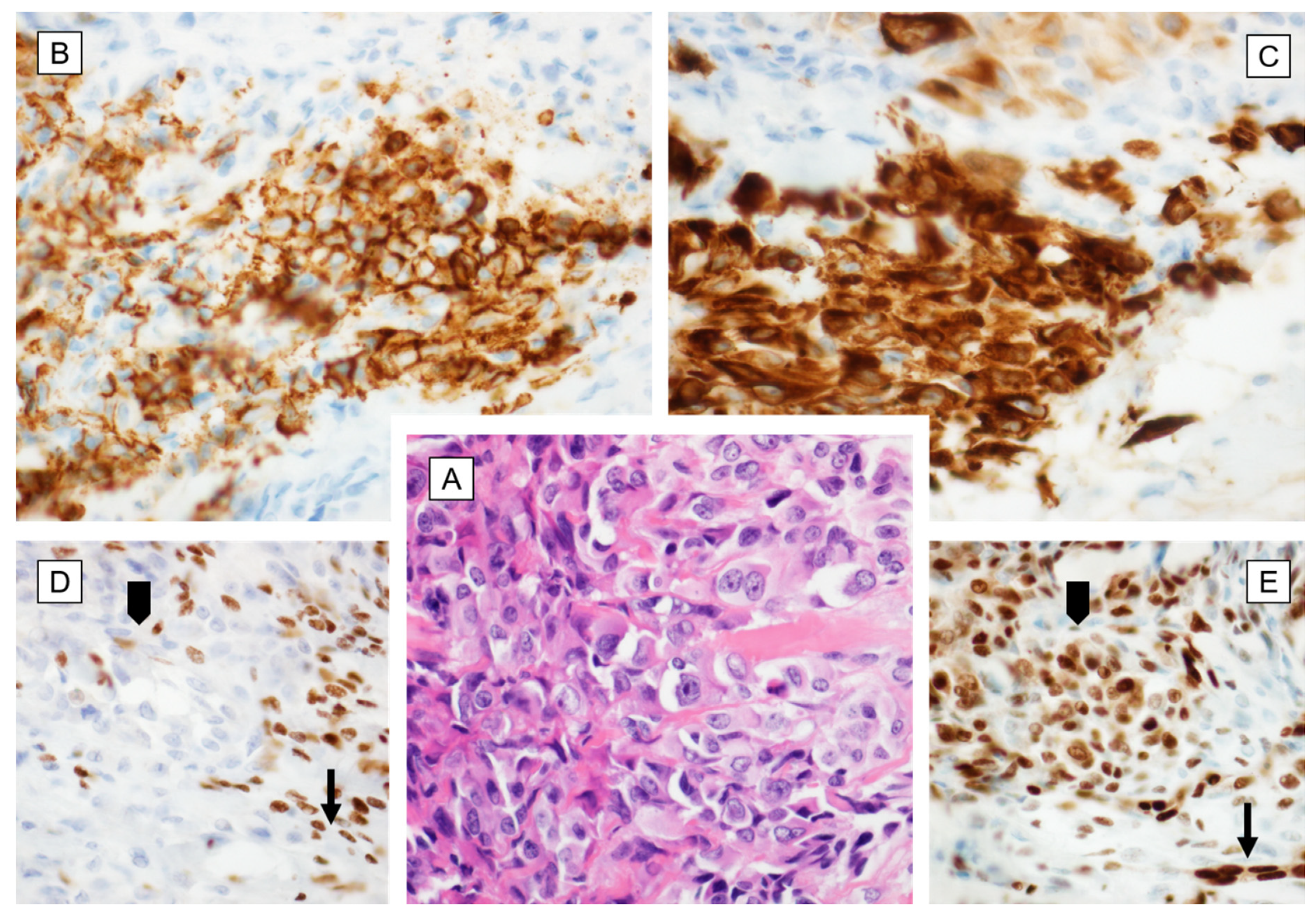 Cancers 12 02112 g003