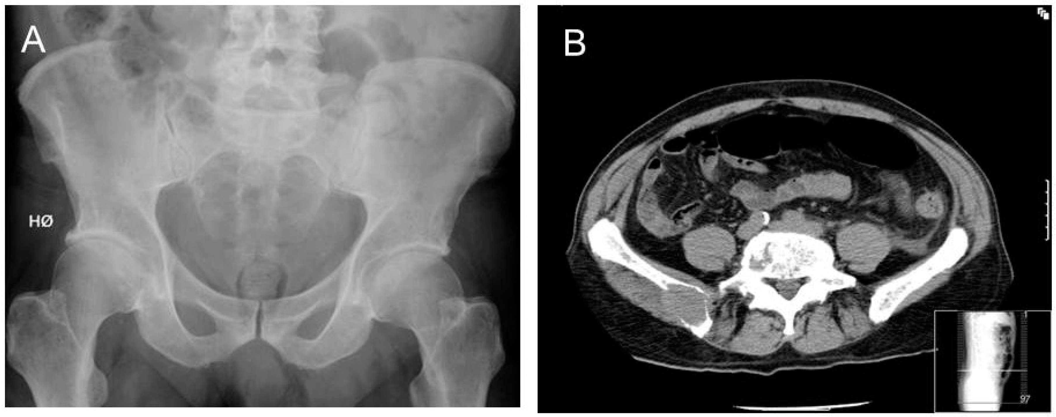 Cancers 12 02113 g002