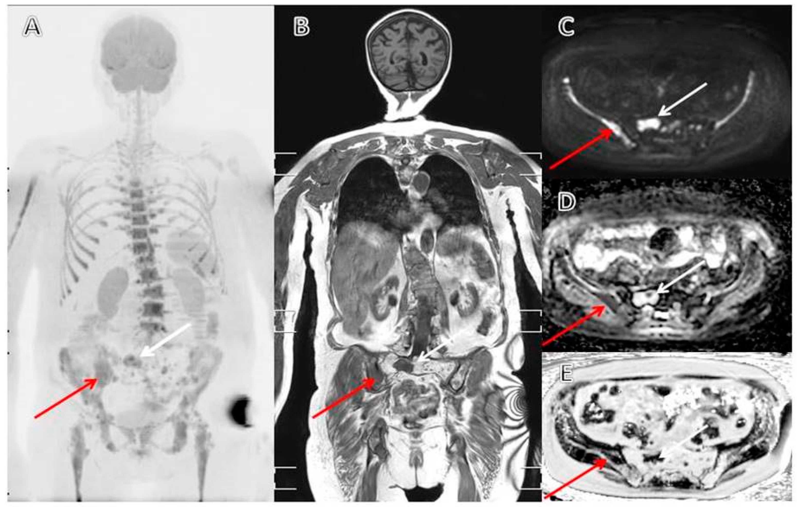 Cancers 12 02113 g003