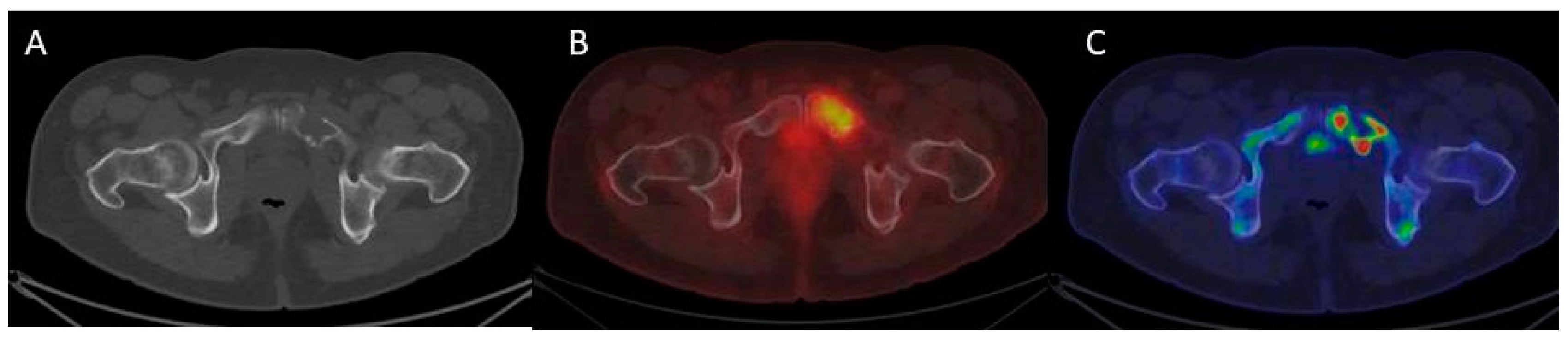 Cancers 12 02113 g004