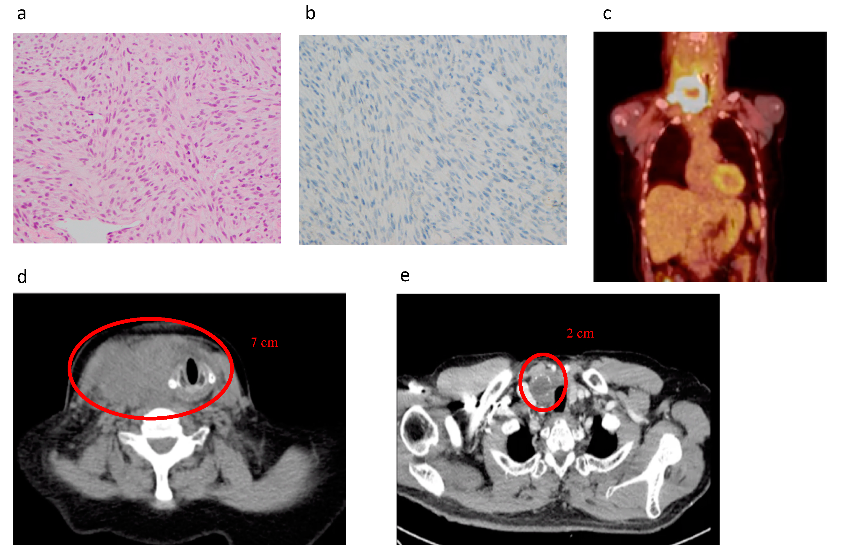 Cancers 12 02164 g003