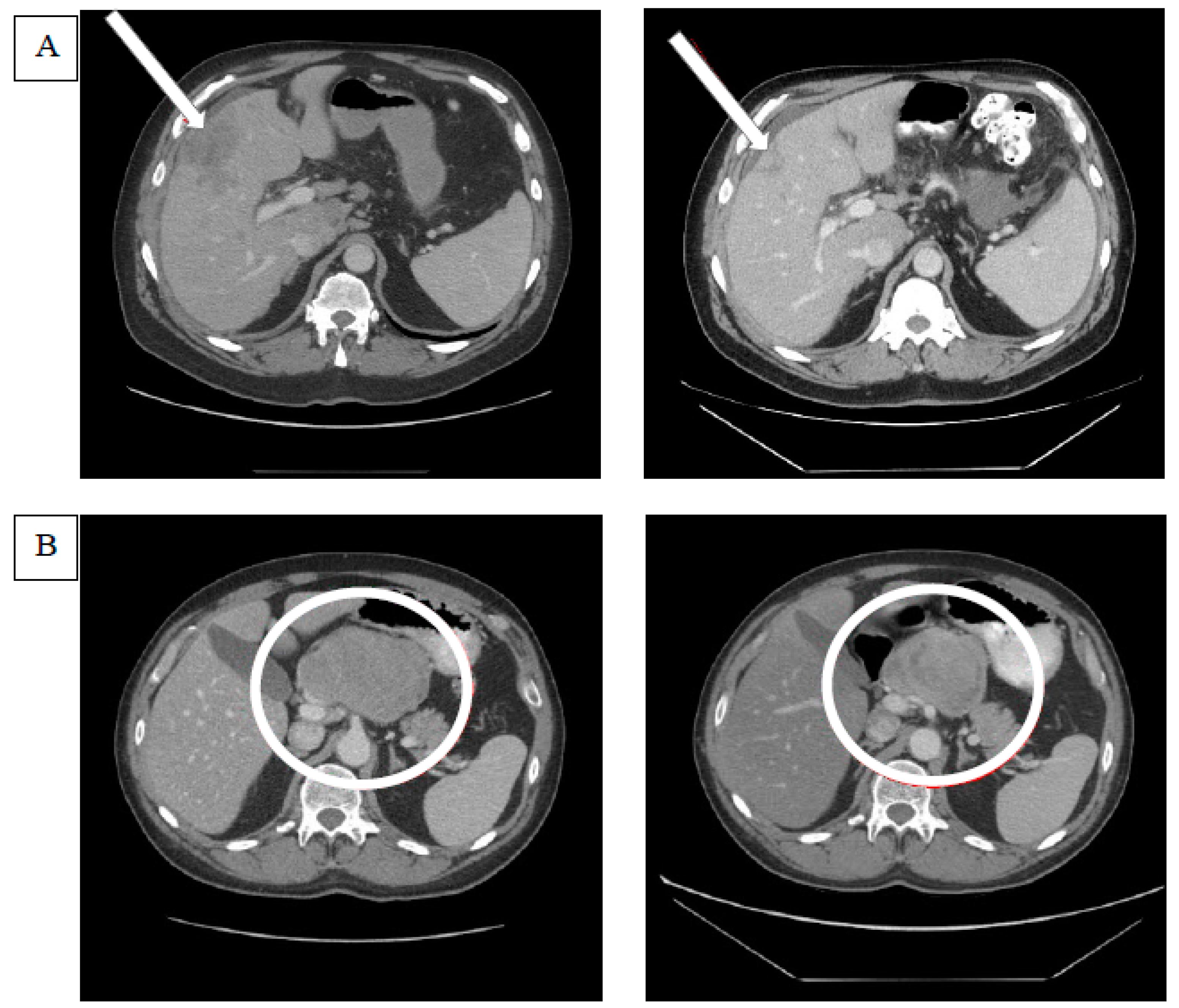 Cancers 12 02270 g002