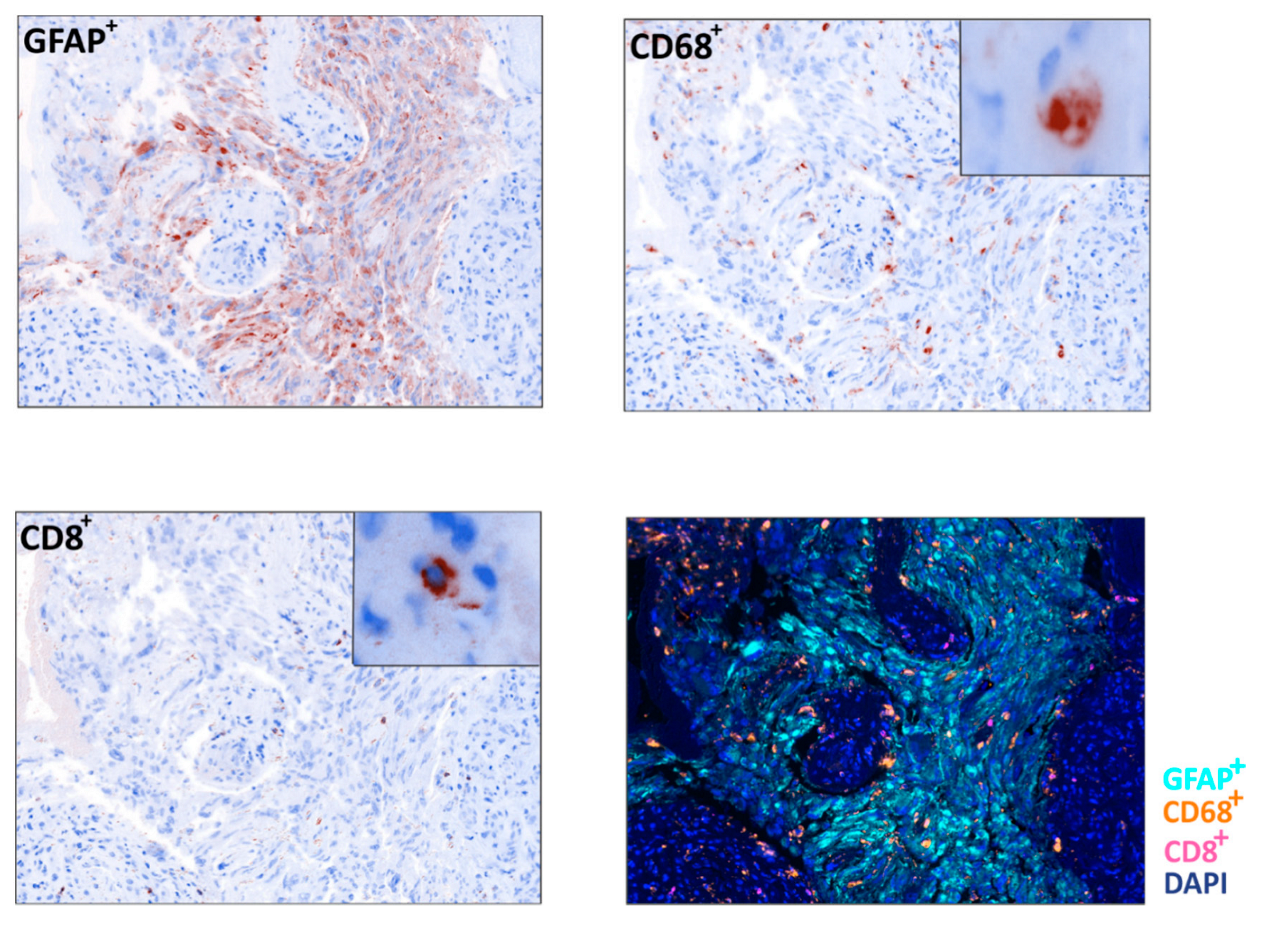 Cancers 12 02283 g004