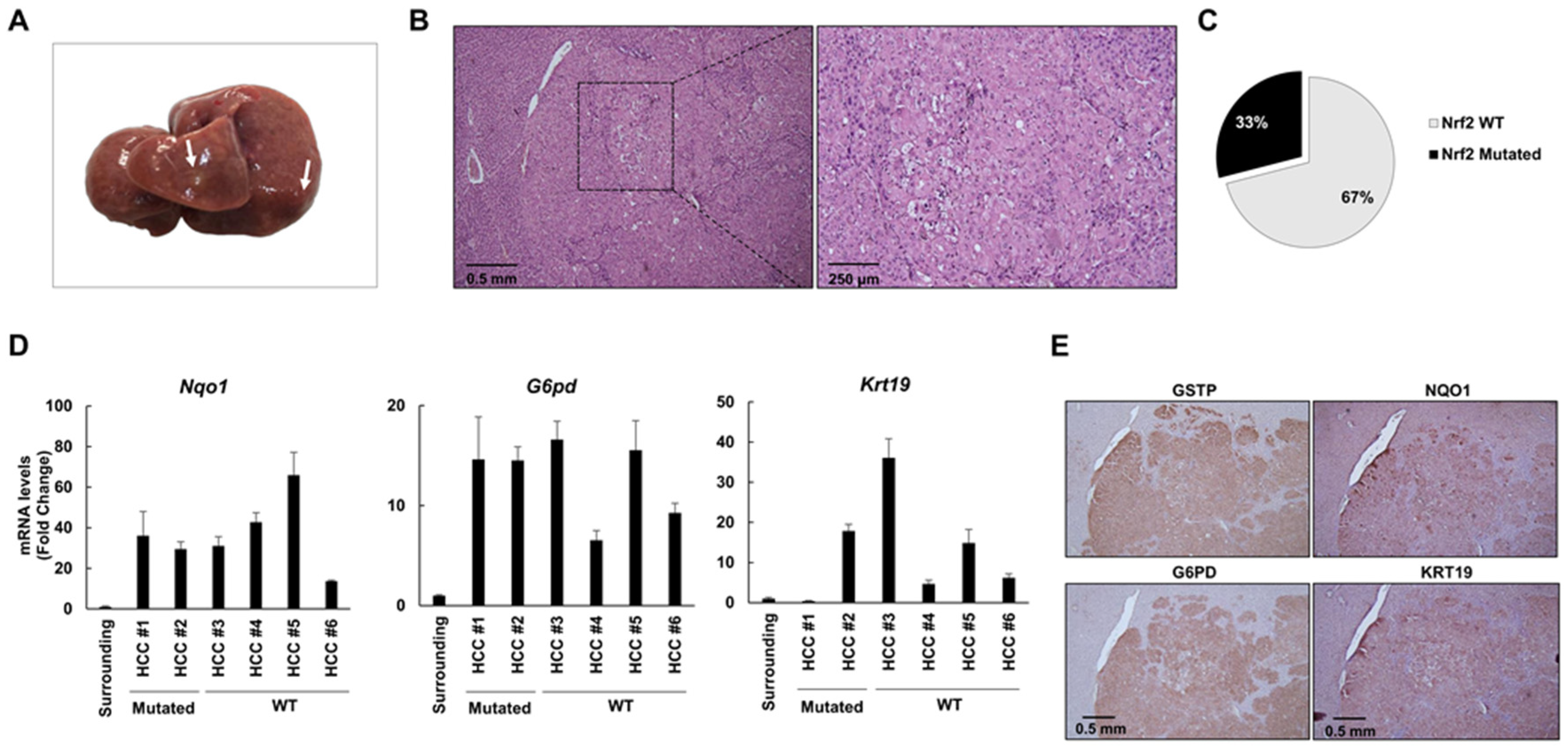 Cancers 12 02305 g004