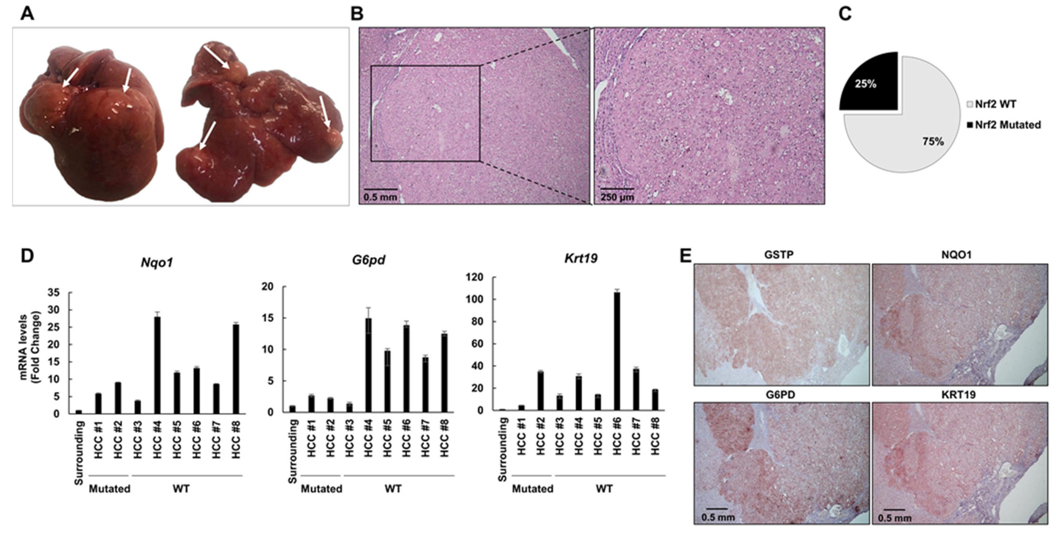 Cancers 12 02305 g005