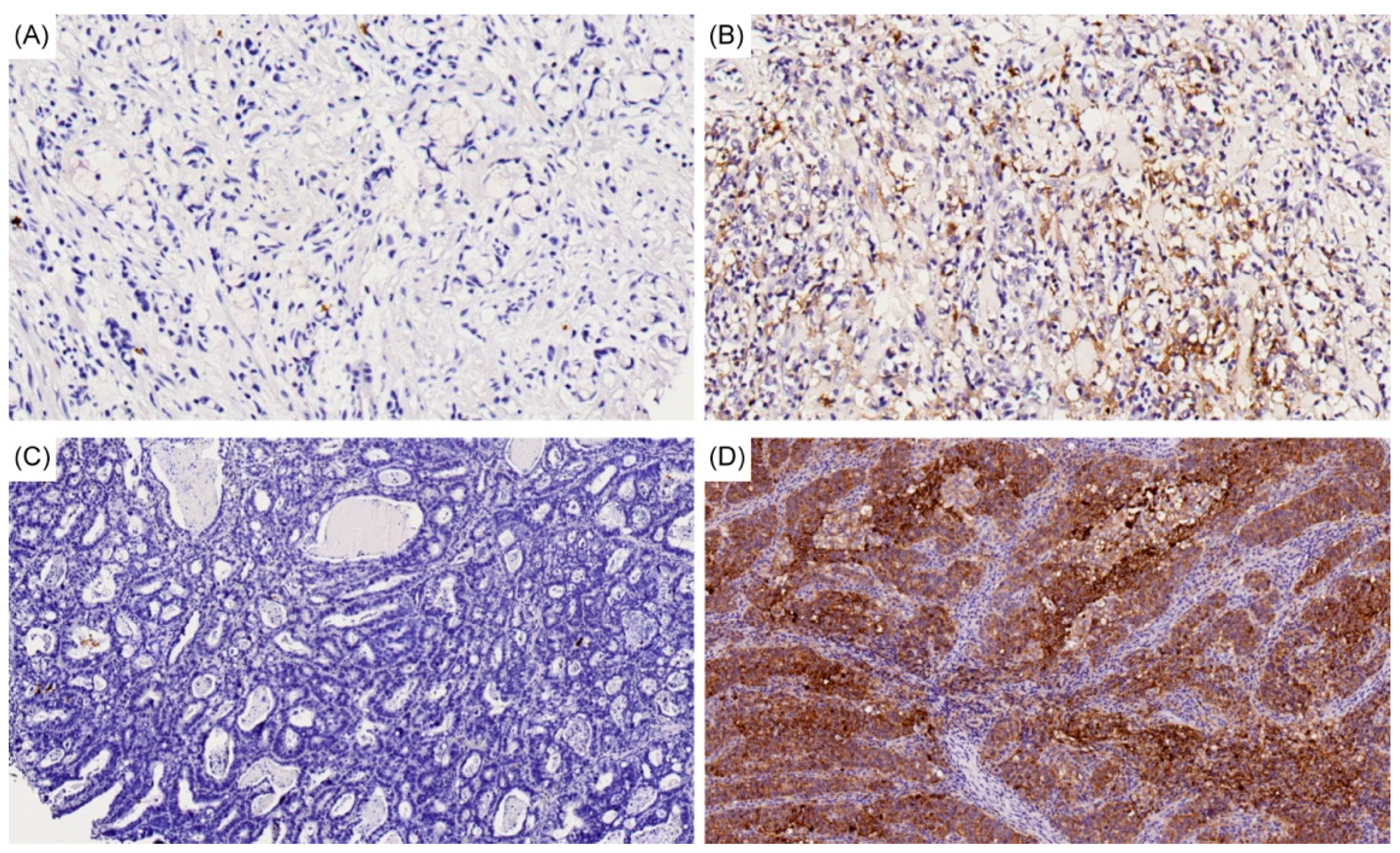 Cancers 12 02318 g003