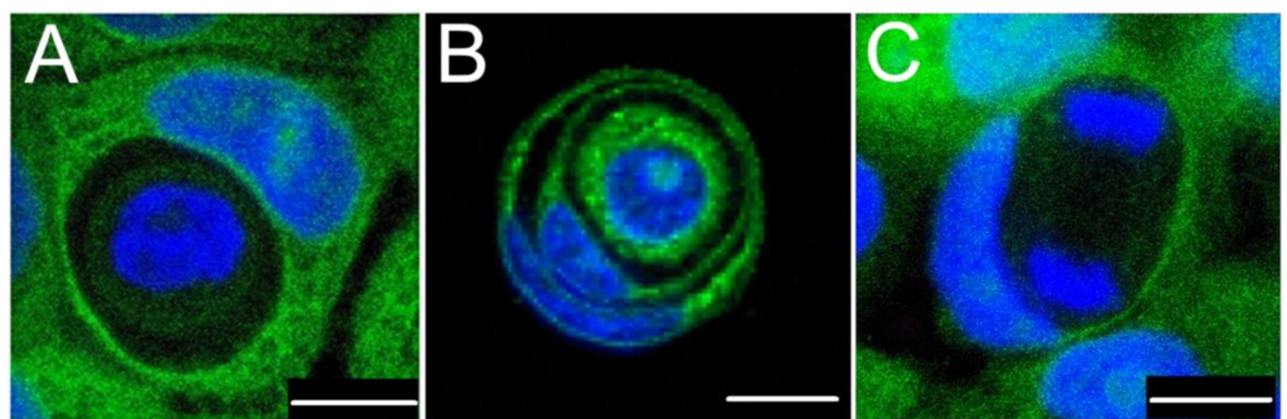 Cancers 12 02481 g005 Cancers 12 02481 g005