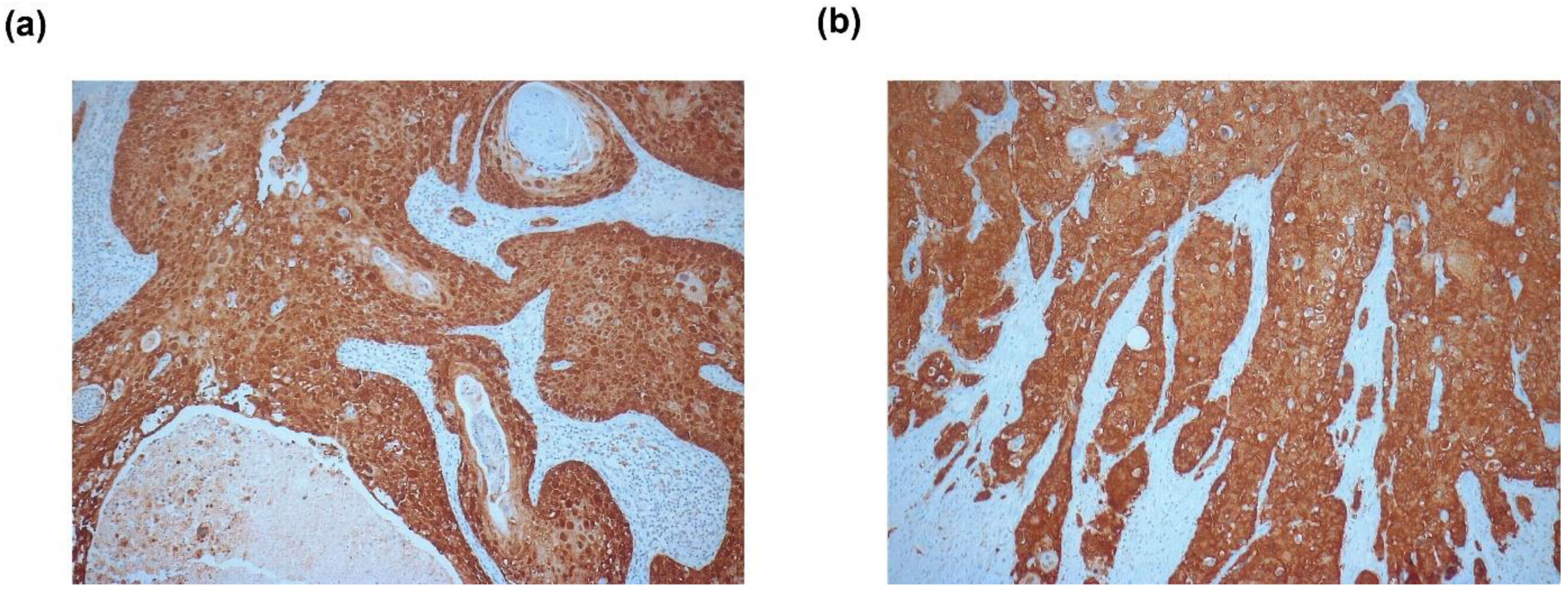 Cancers 12 02516 g001 Cancers 12 02516 g001