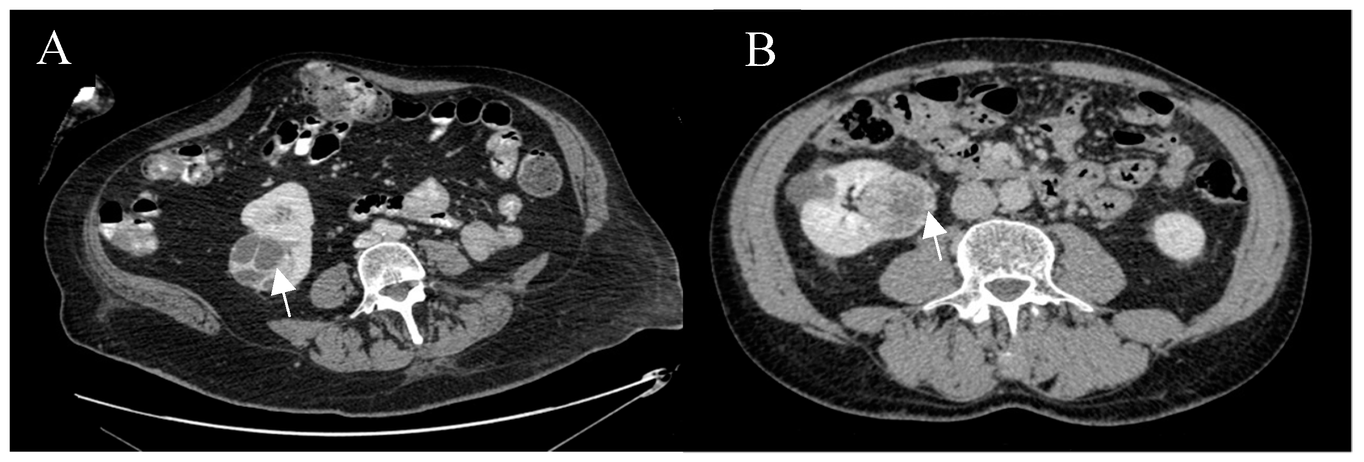 Cancers 12 02549 g006