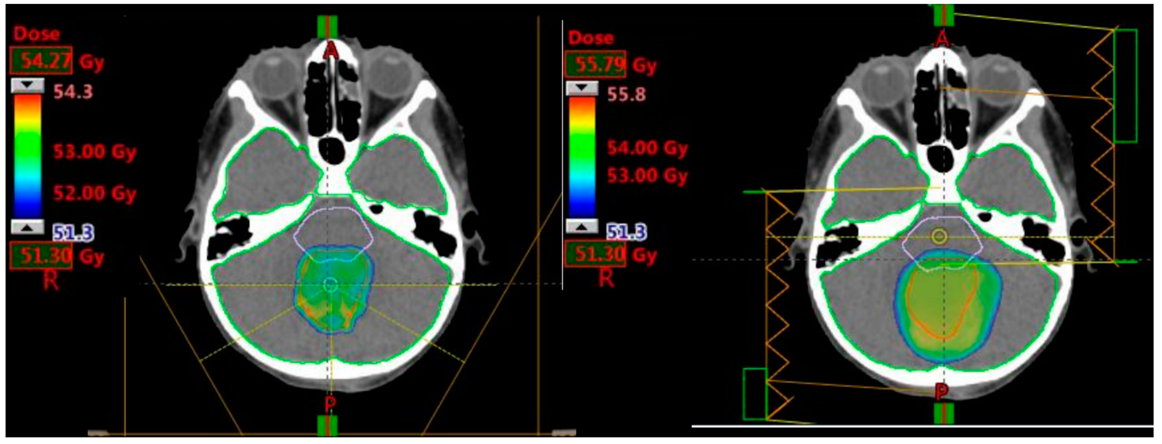 Cancers 12 02578 g004
