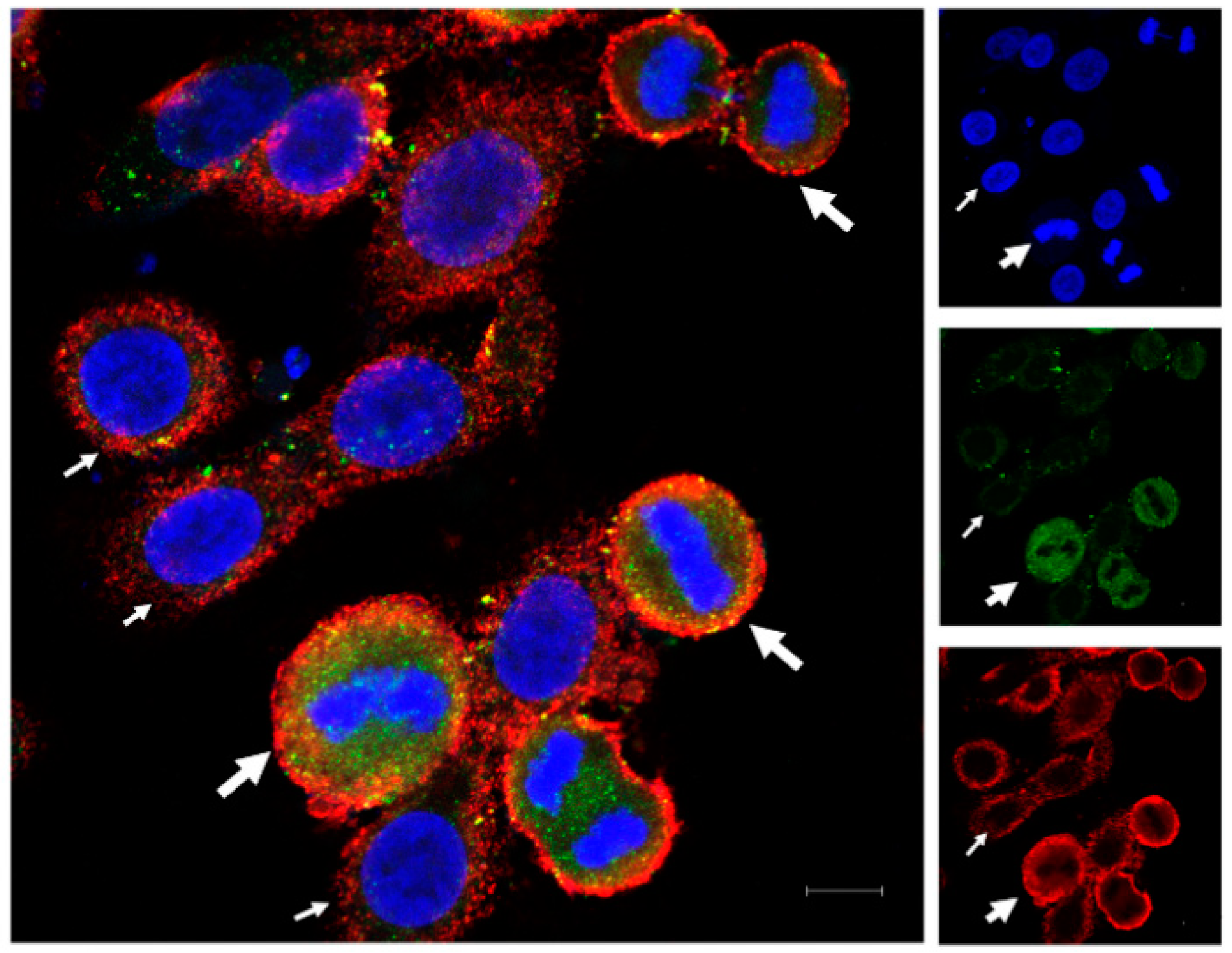 Cancers 12 02661 g001