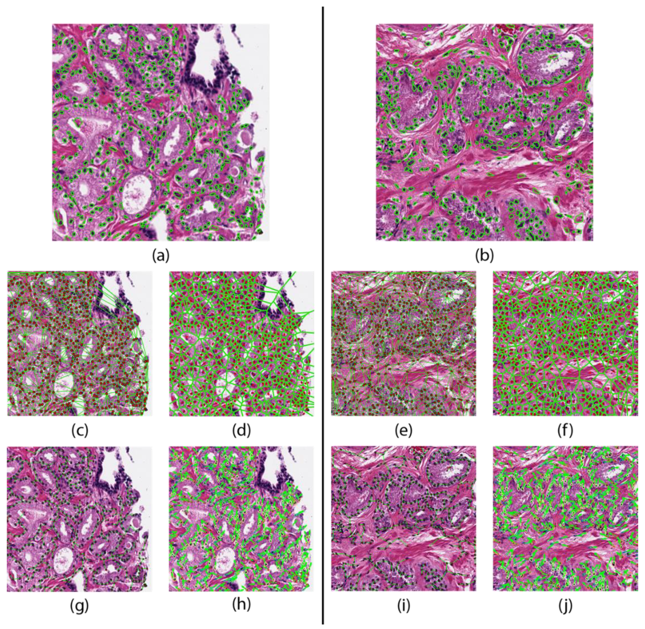 Cancers 12 02708 g001