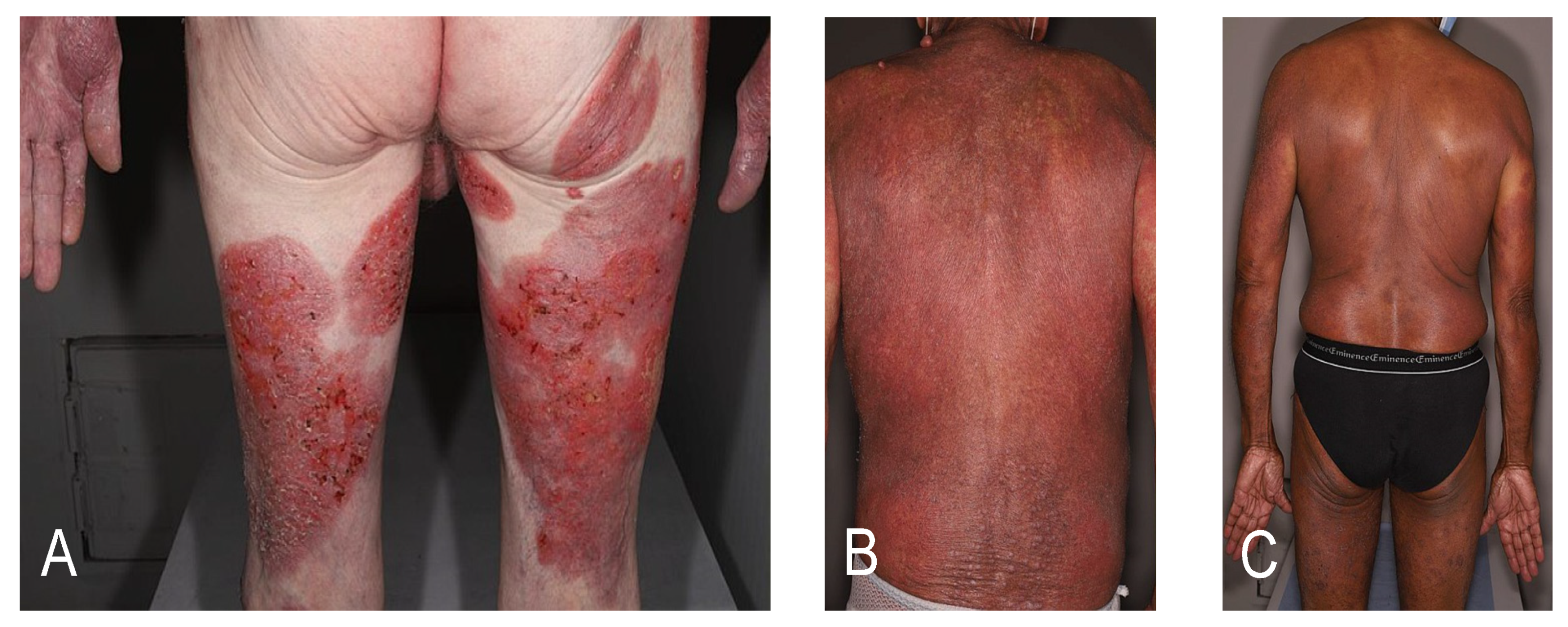 Cancers 12 02856 g001