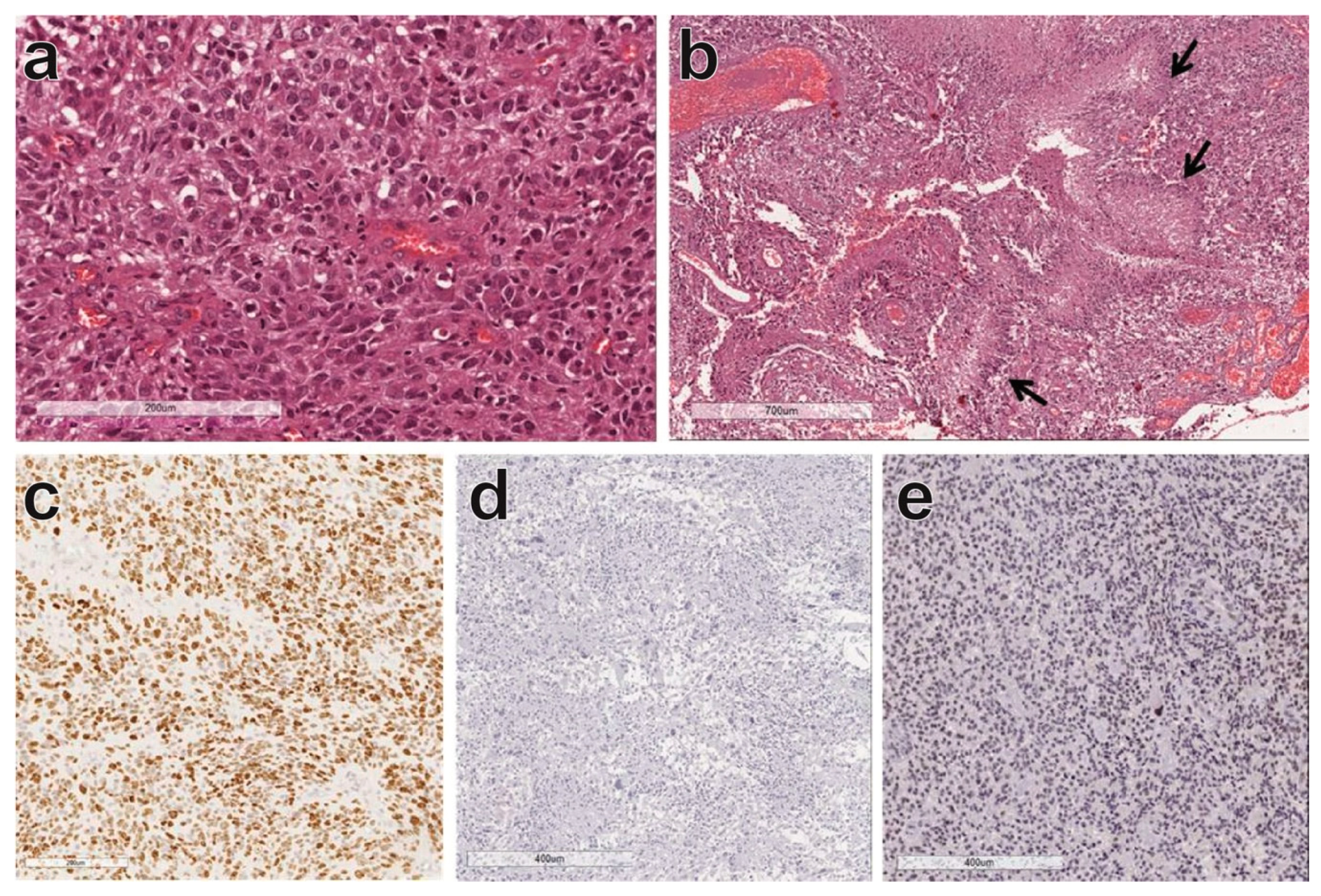 Cancers 12 02860 g001