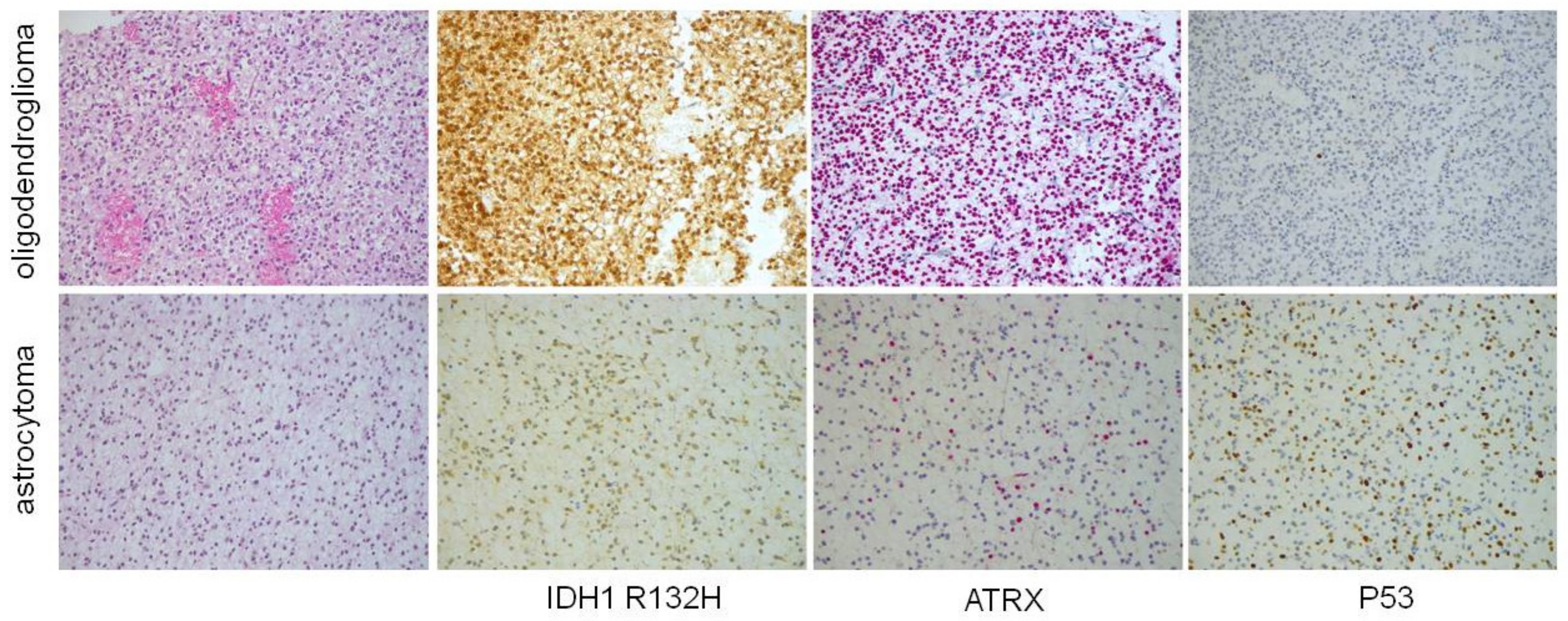 Cancers 12 03008 g001 Cancers 12 03008 g001