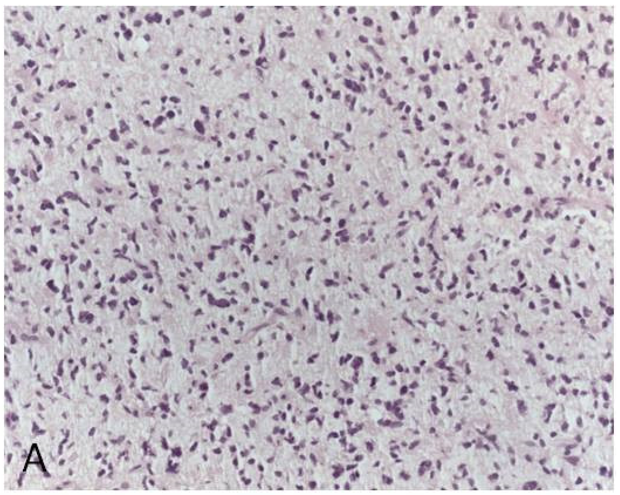 Cancers 12 03008 g002a Cancers 12 03008 g002a