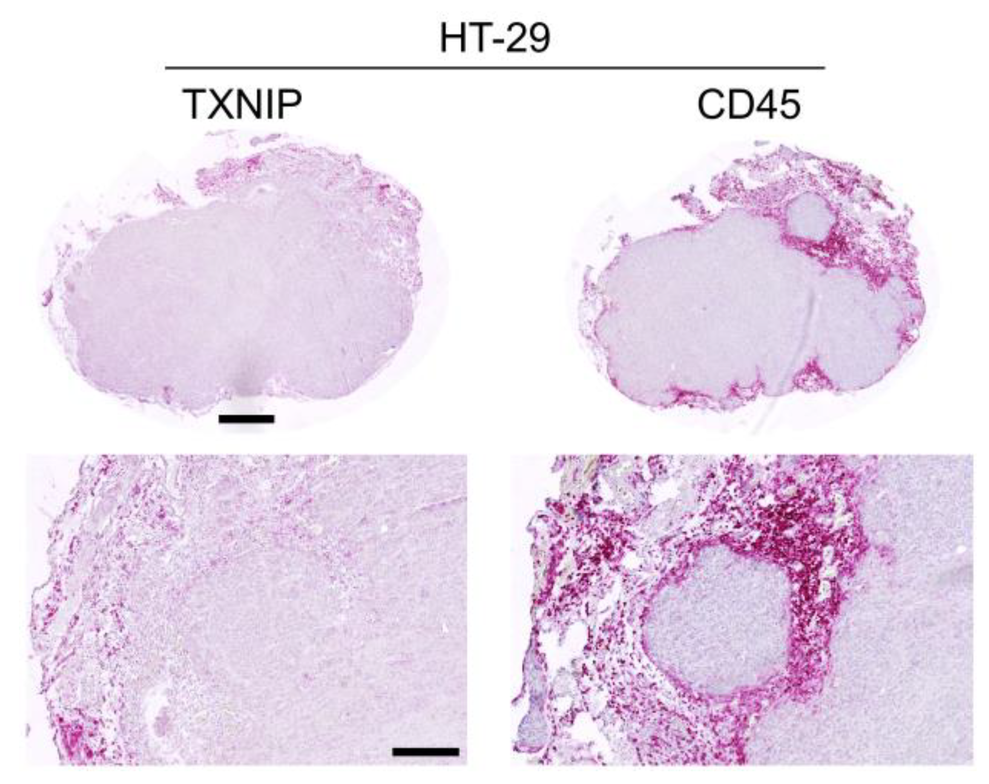 Cancers 12 03028 g004