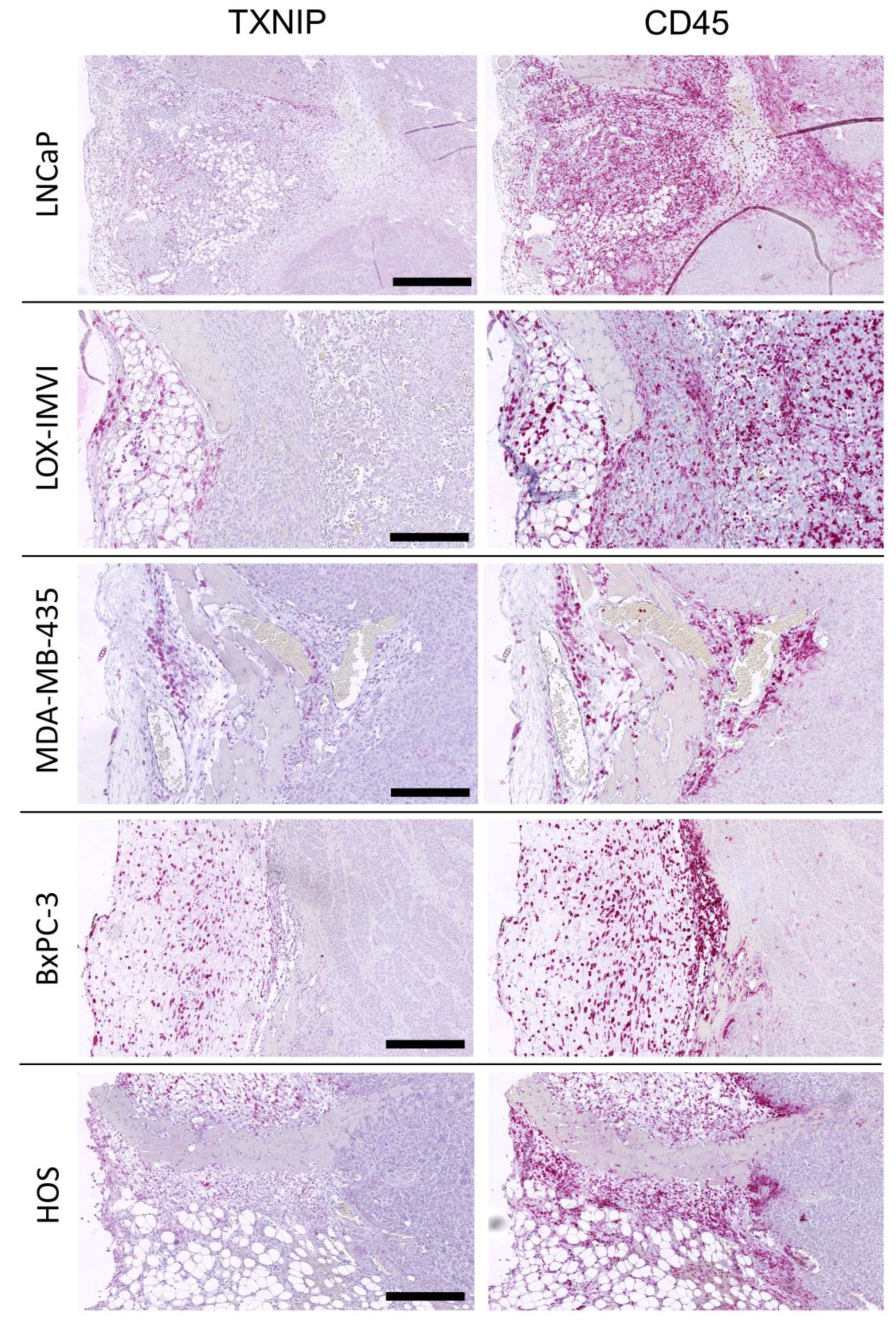 Cancers 12 03028 g005