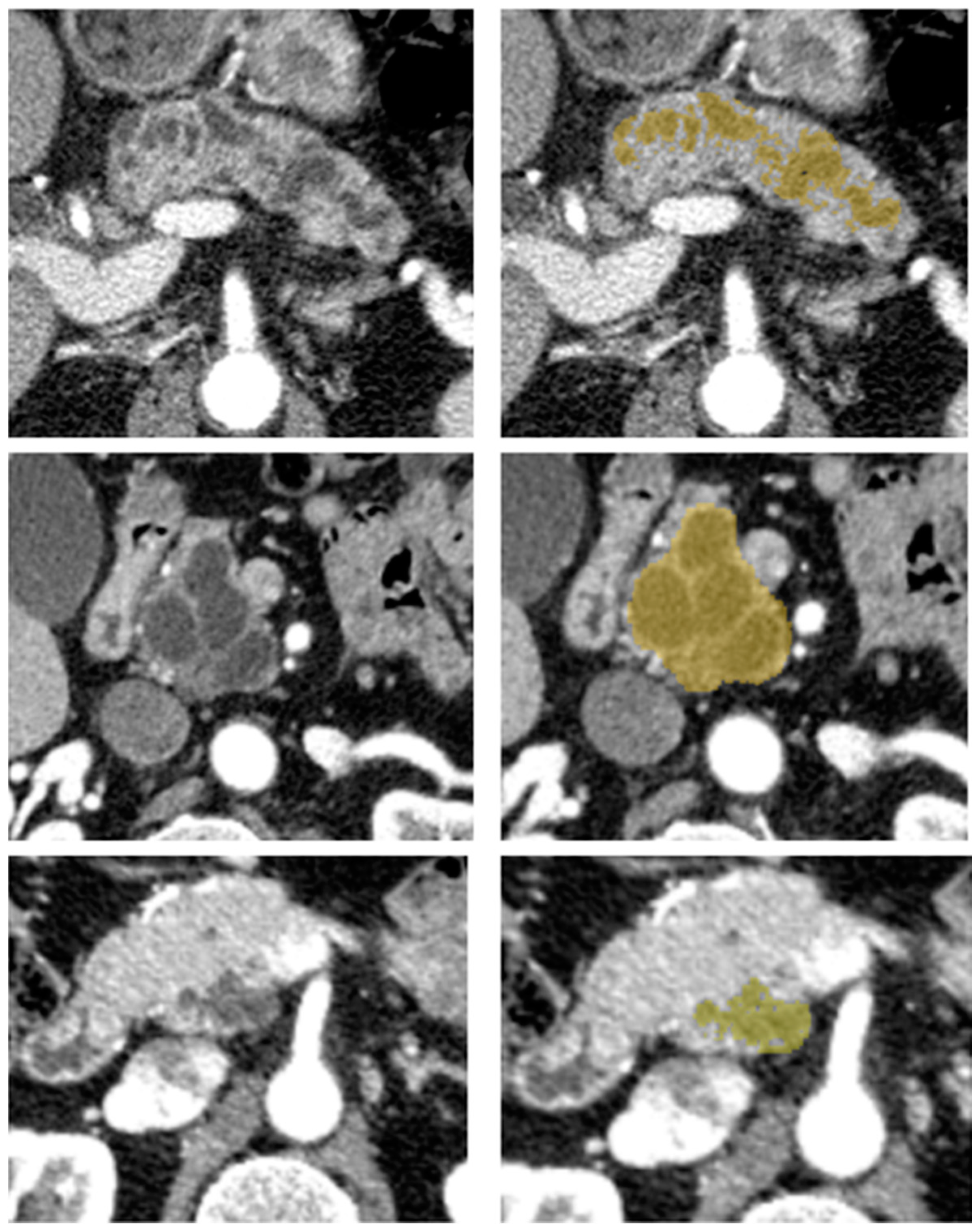 Cancers 12 03089 g002 Cancers 12 03089 g002