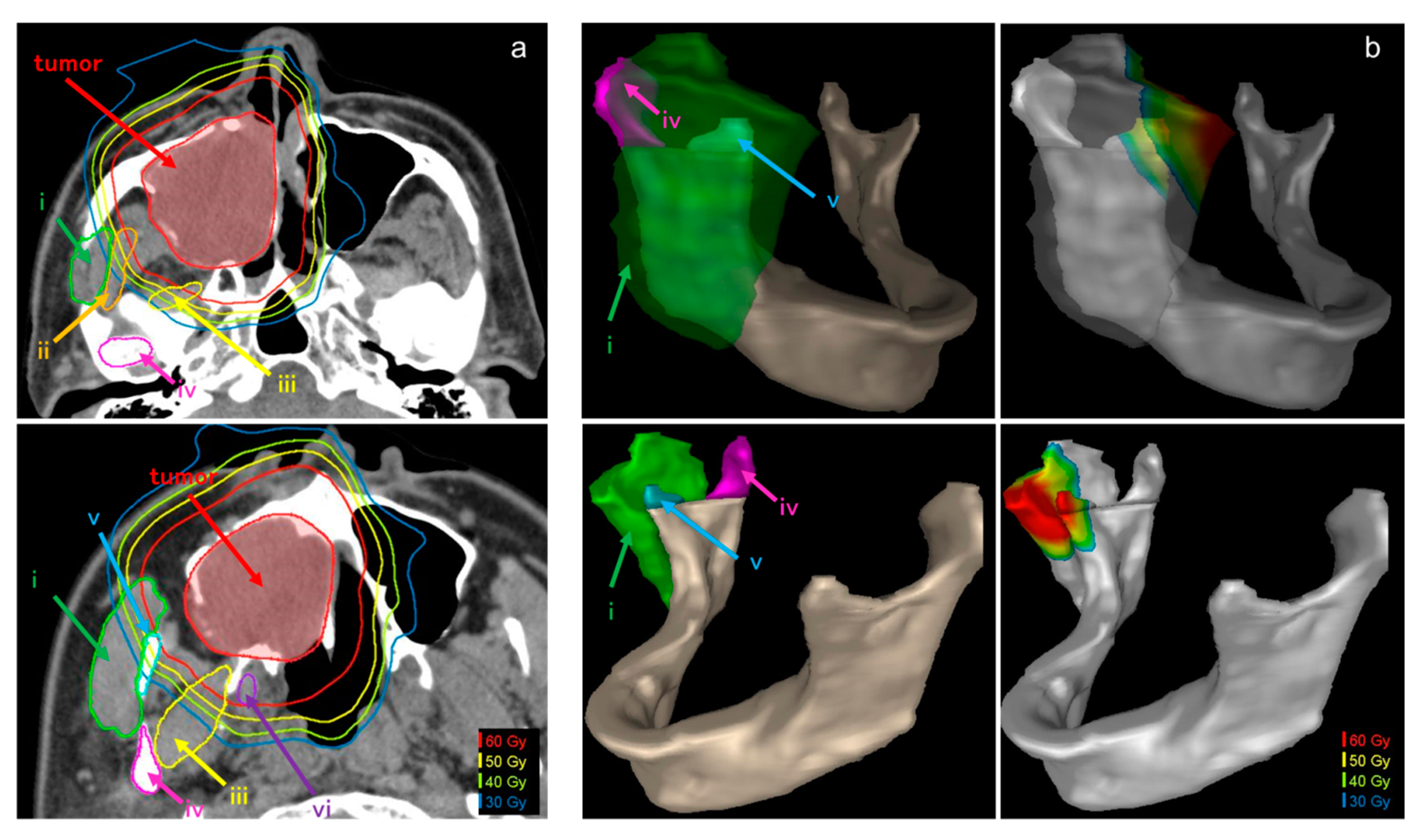 Cancers 12 03116 g002