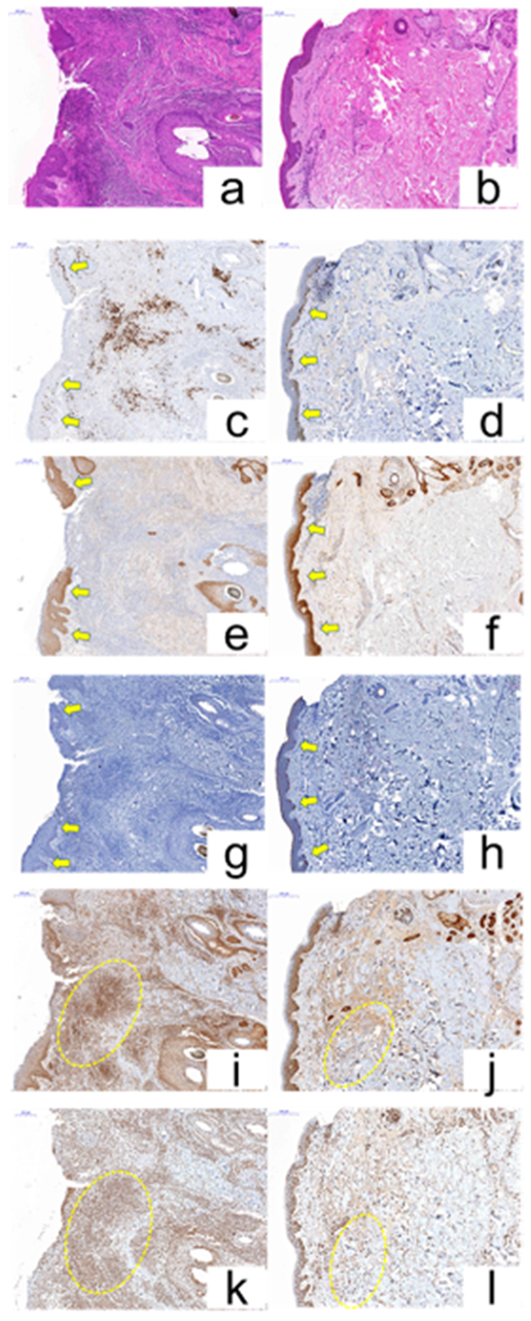 Cancers 12 03120 g007 Cancers 12 03120 g007