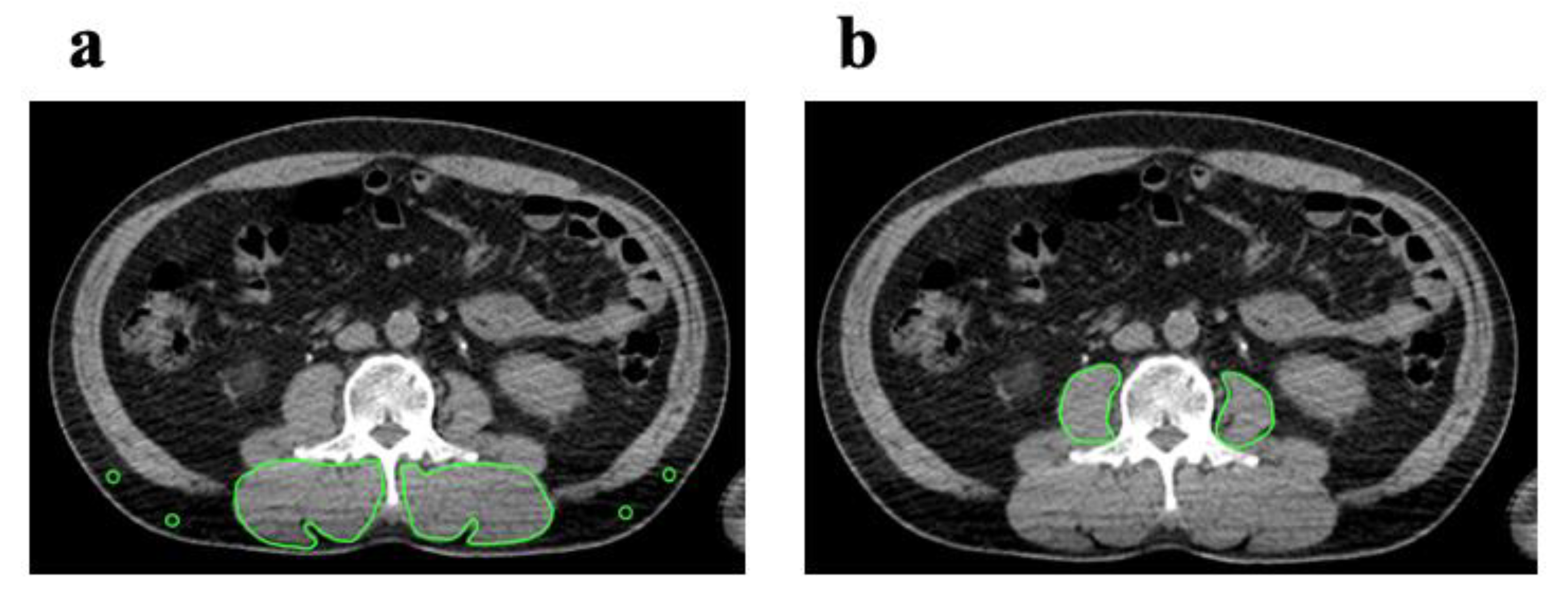 Cancers 12 03167 g001
