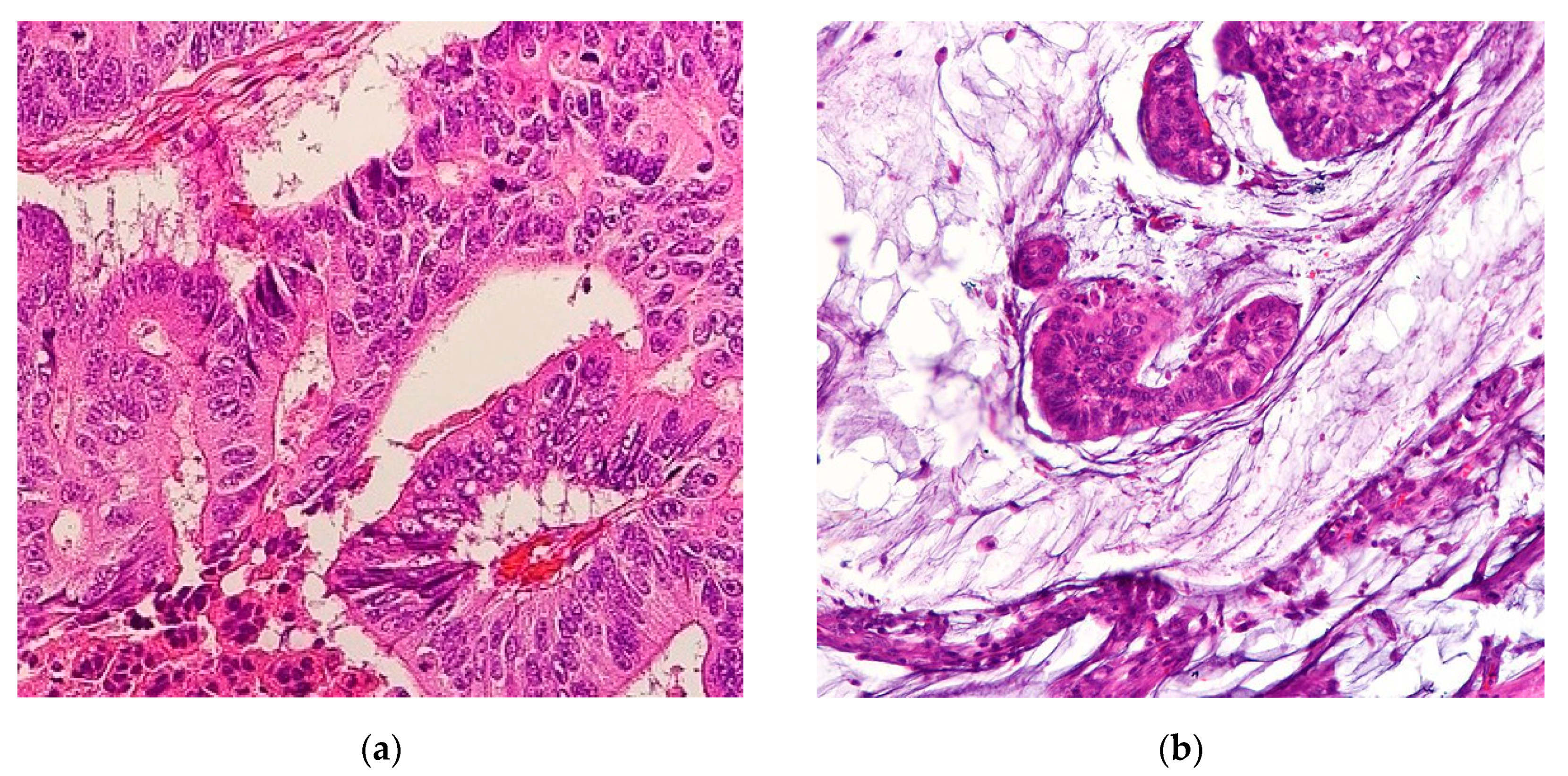 Cancers 12 03193 g001 Cancers 12 03193 g001