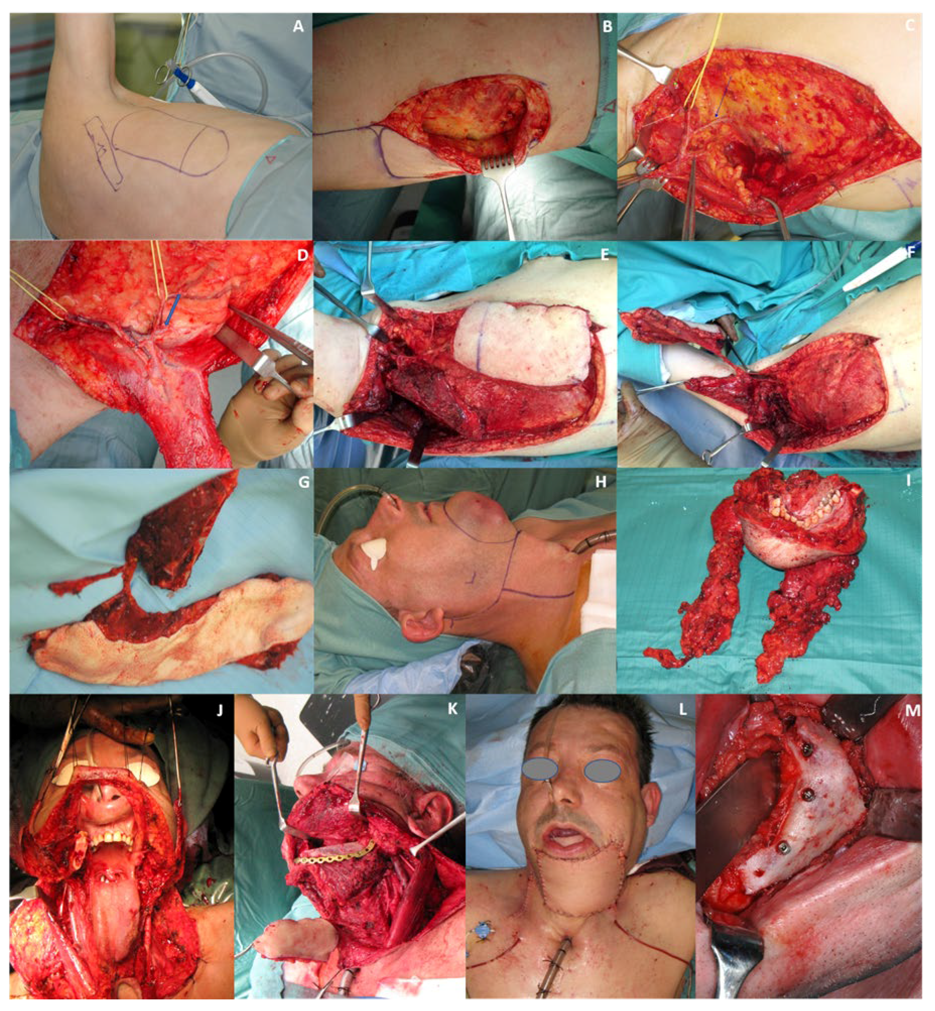 Cancers 12 03198 g003