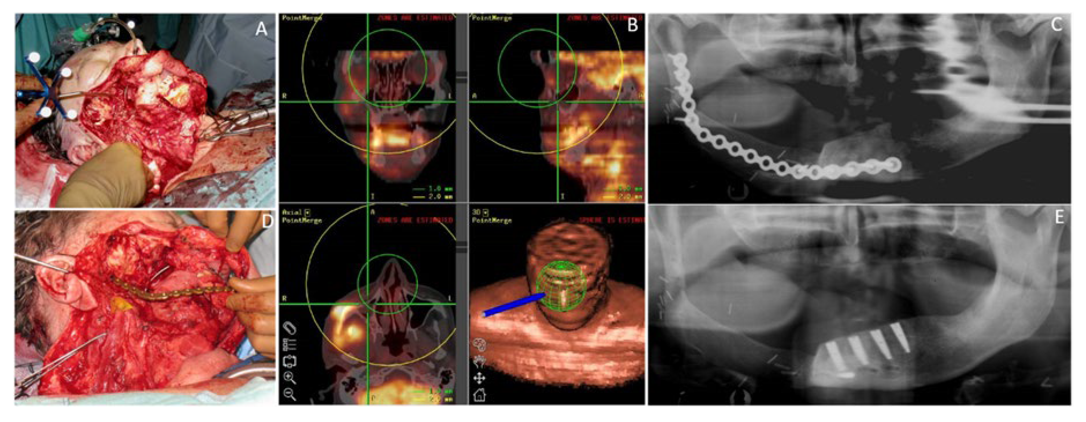 Cancers 12 03198 g005