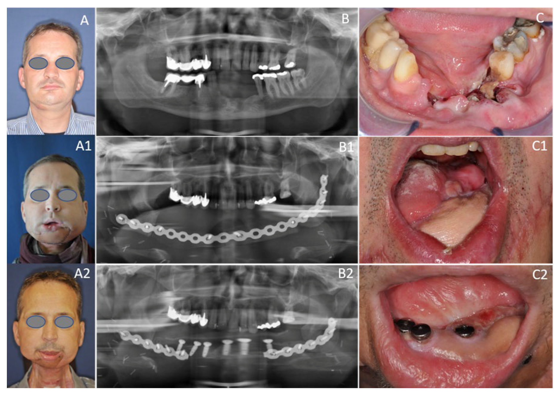 Cancers 12 03198 g006