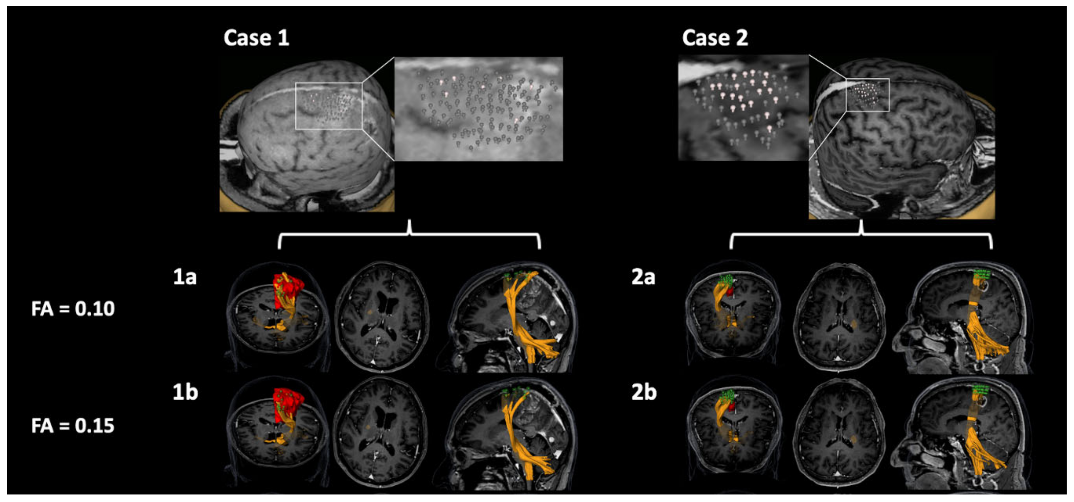 Cancers 12 03233 g006
