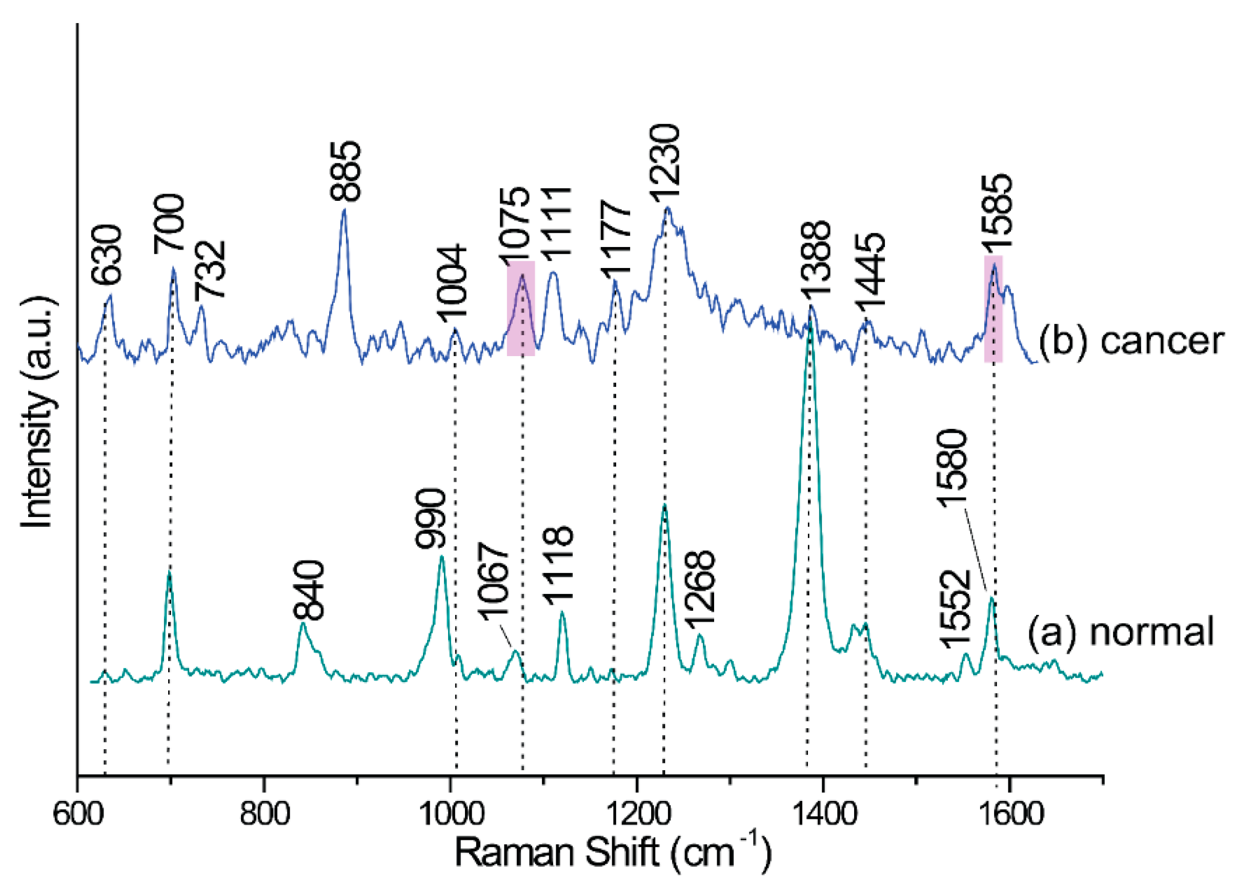 Cancers 12 03315 g006