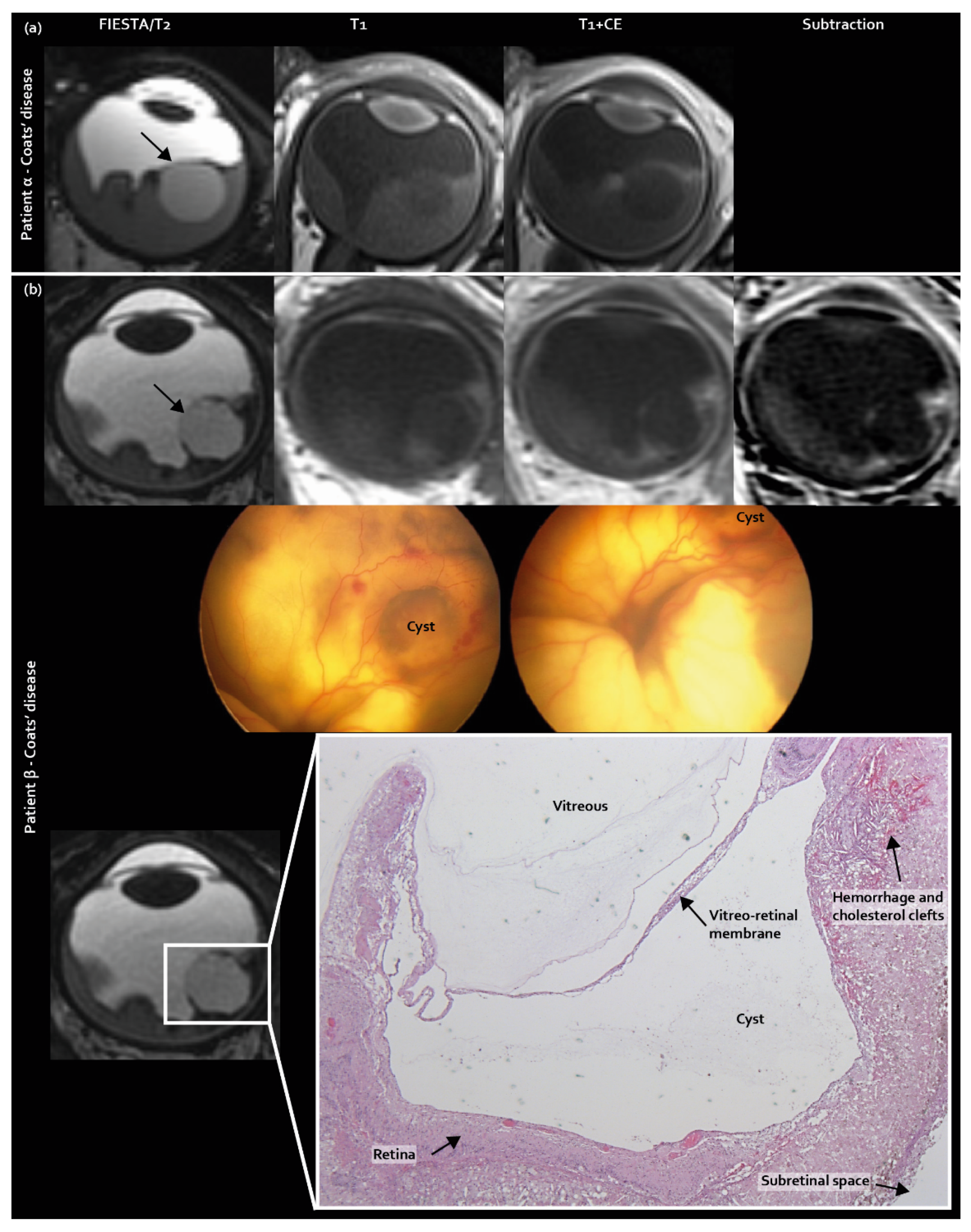 Cancers 12 03592 g001