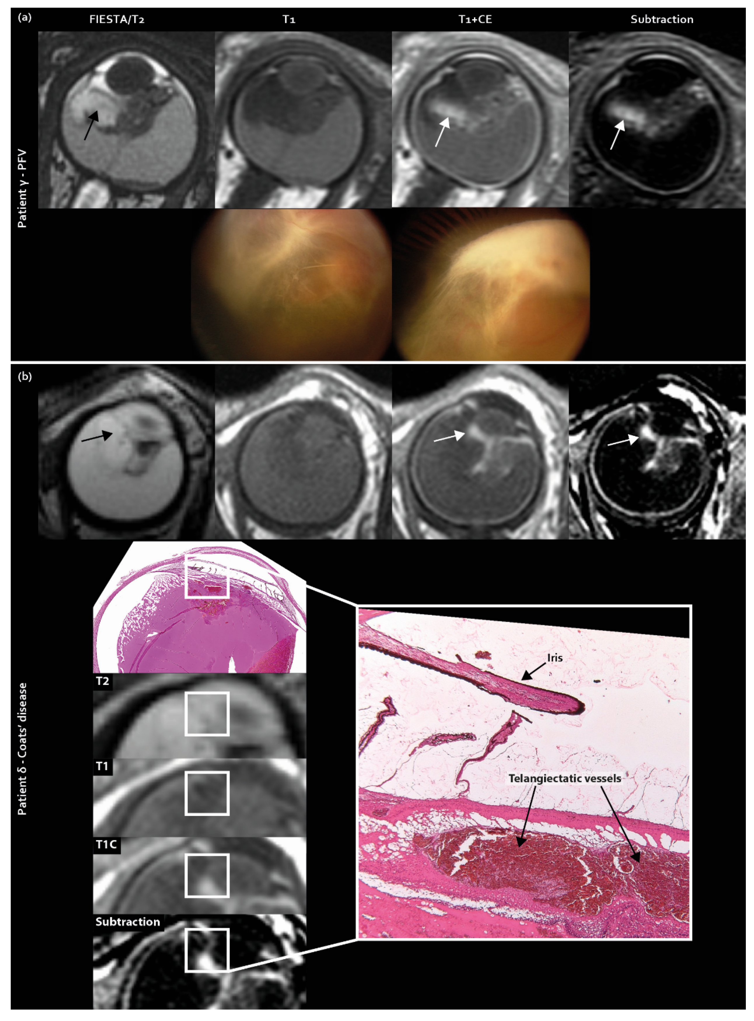 Cancers 12 03592 g002