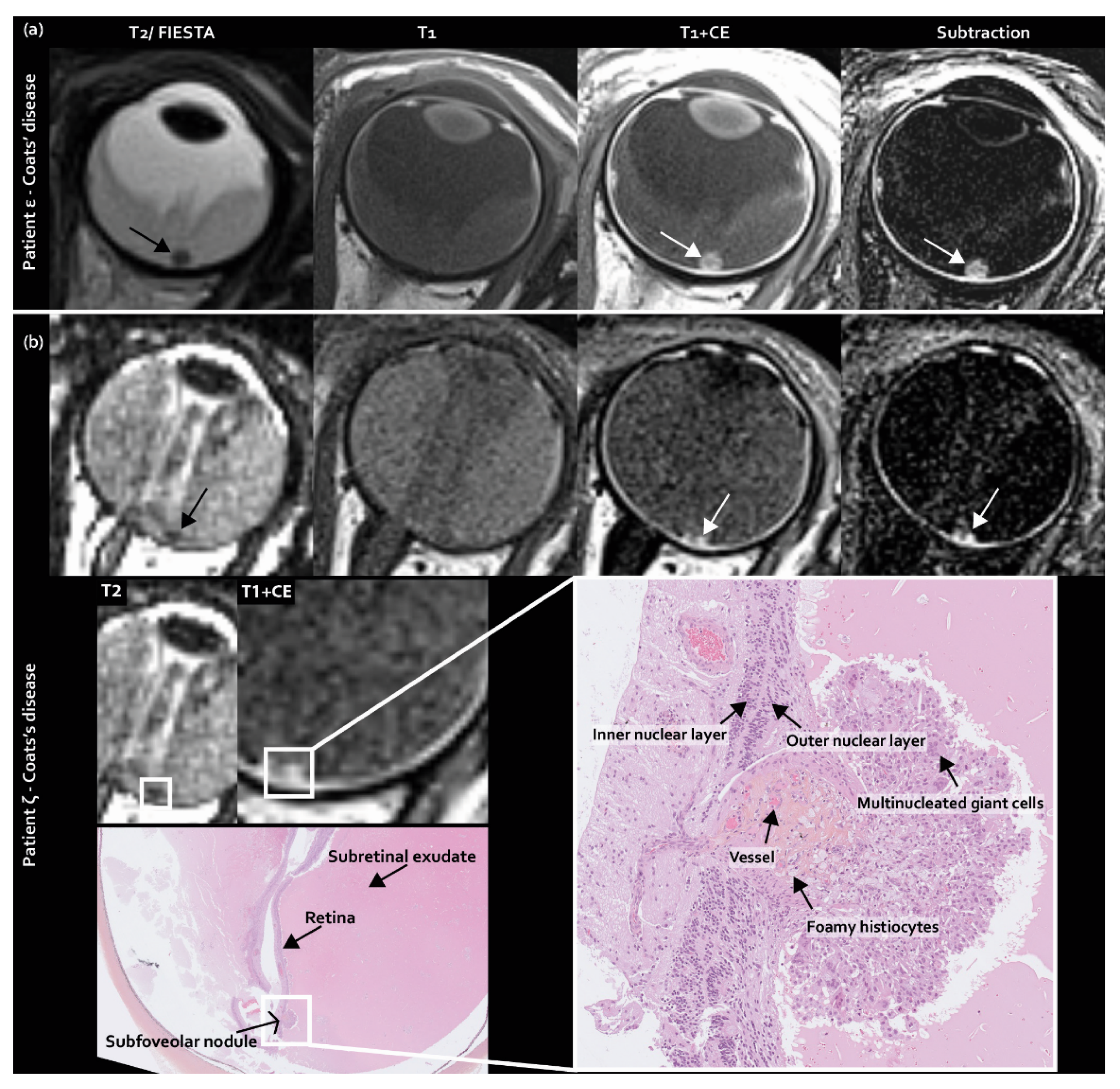 Cancers 12 03592 g003