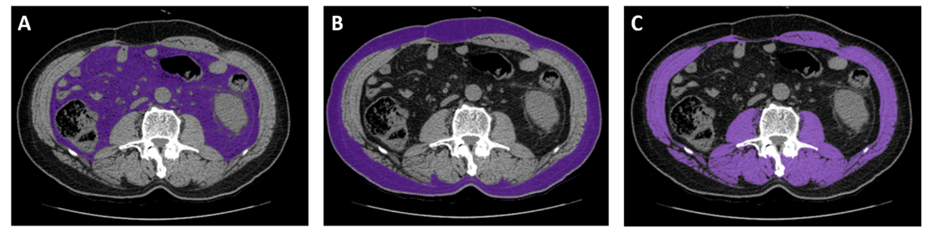 Cancers 12 03602 g003