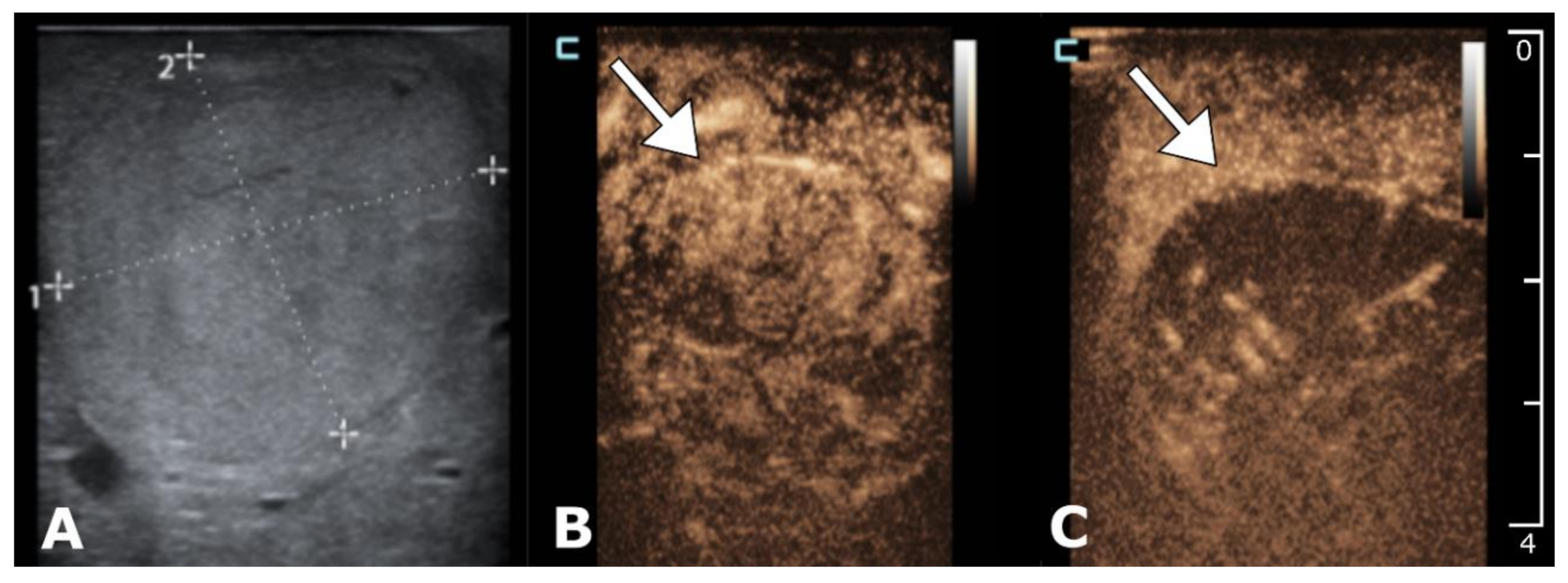 Cancers 12 03778 g004