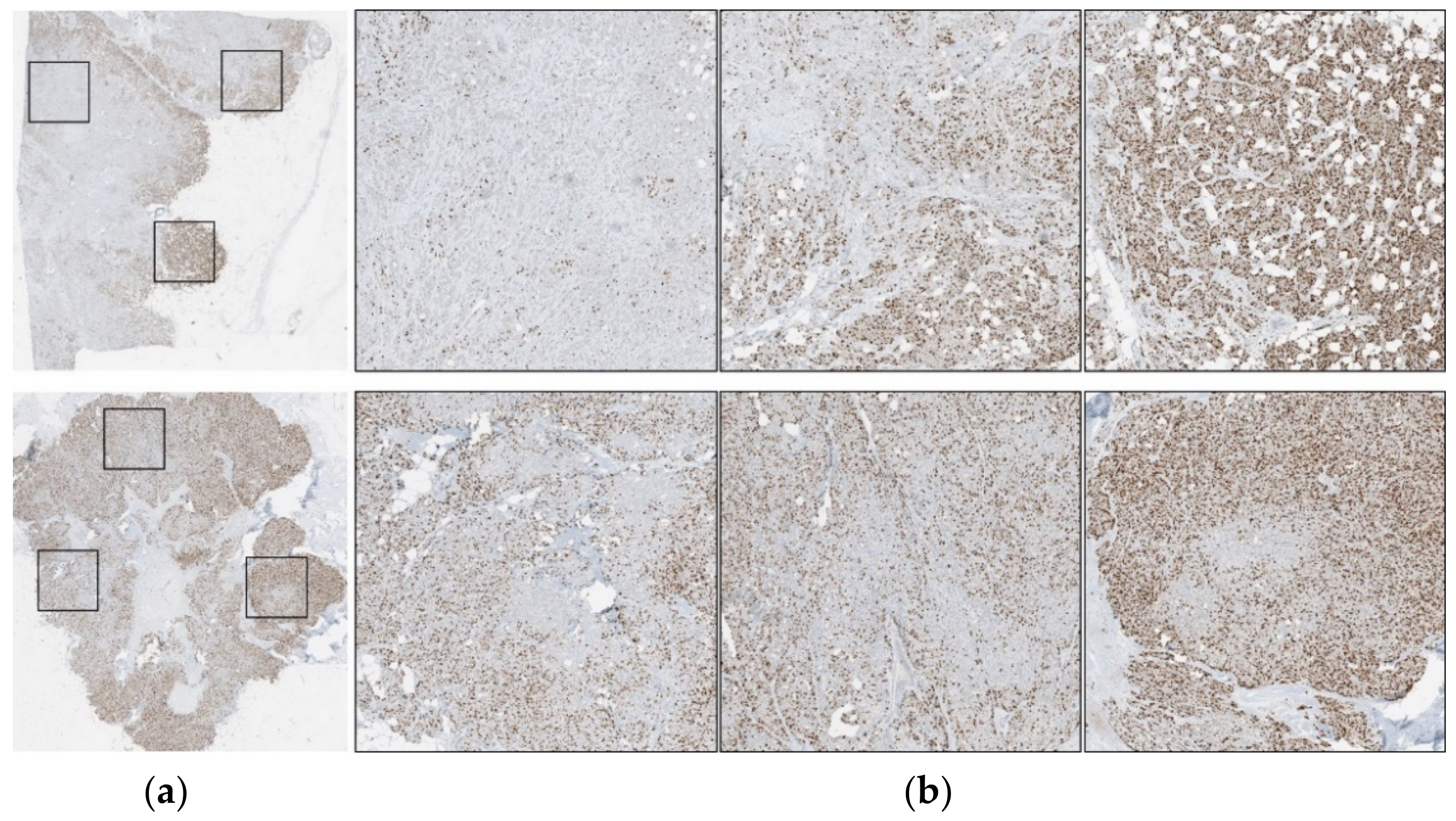 Cancers 13 00011 g003 Cancers 13 00011 g003