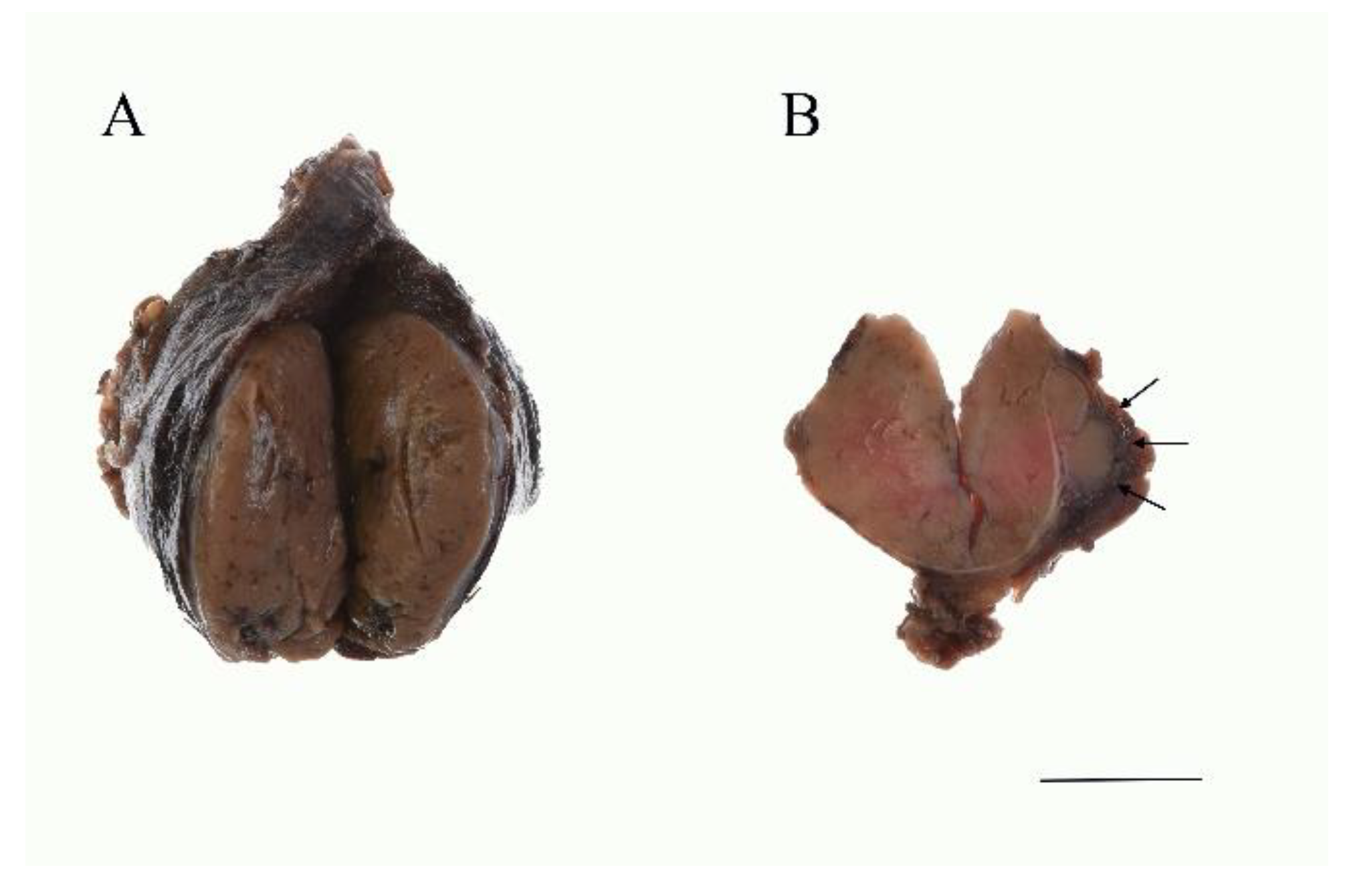 Cancers 13 00026 g002