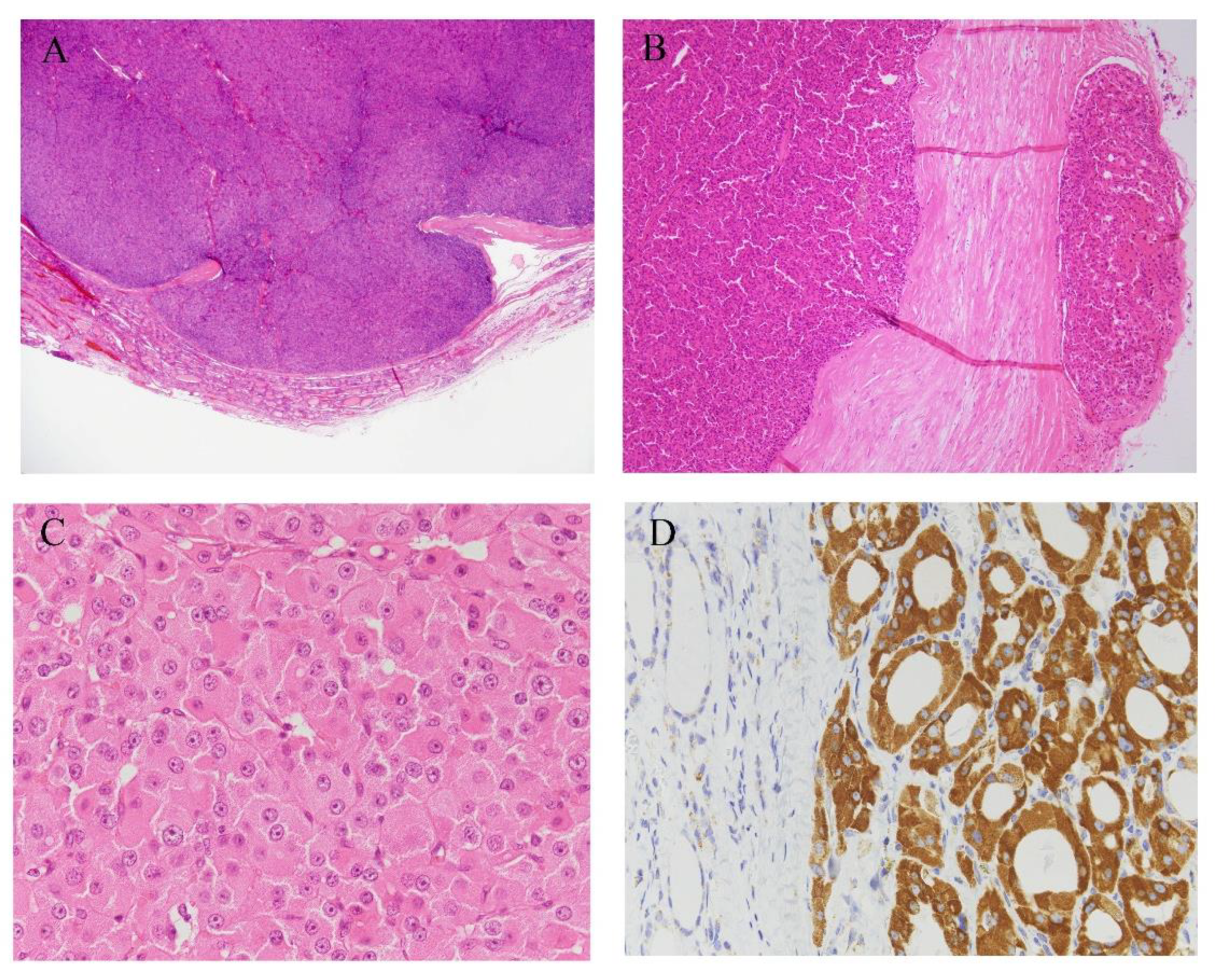 Cancers 13 00026 g003