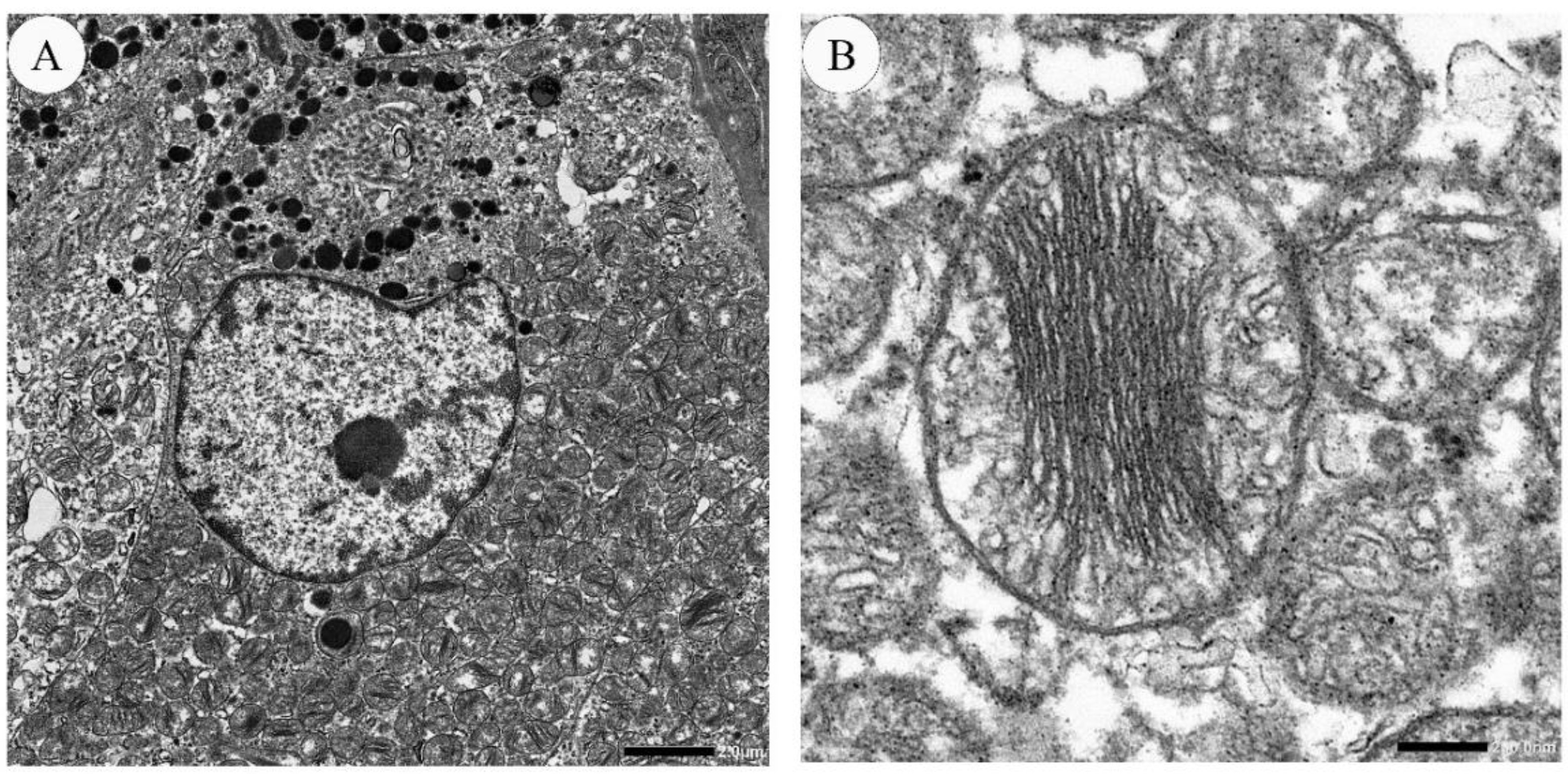 Cancers 13 00026 g004